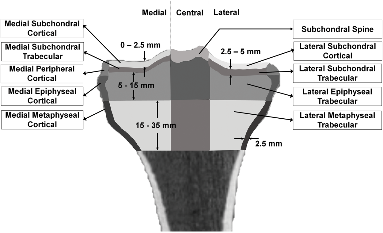 Mechanical Metrics of the Proximal Tibia are Precise and Differentiate  Osteoarthritic and Normal Knees: A Finite Element Study | Scientific Reports