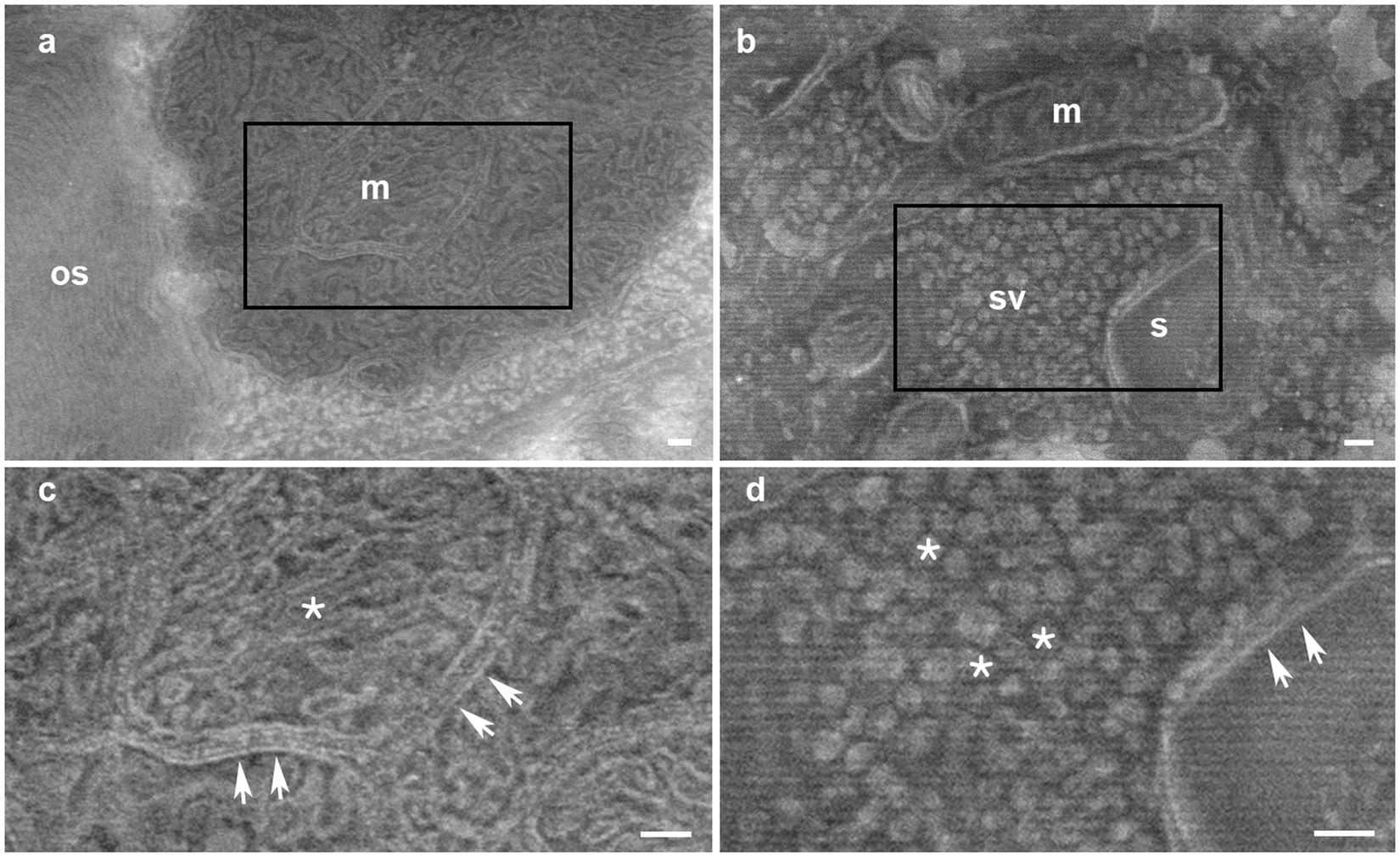 A high magnification image of synapse obtained by electron microscopy