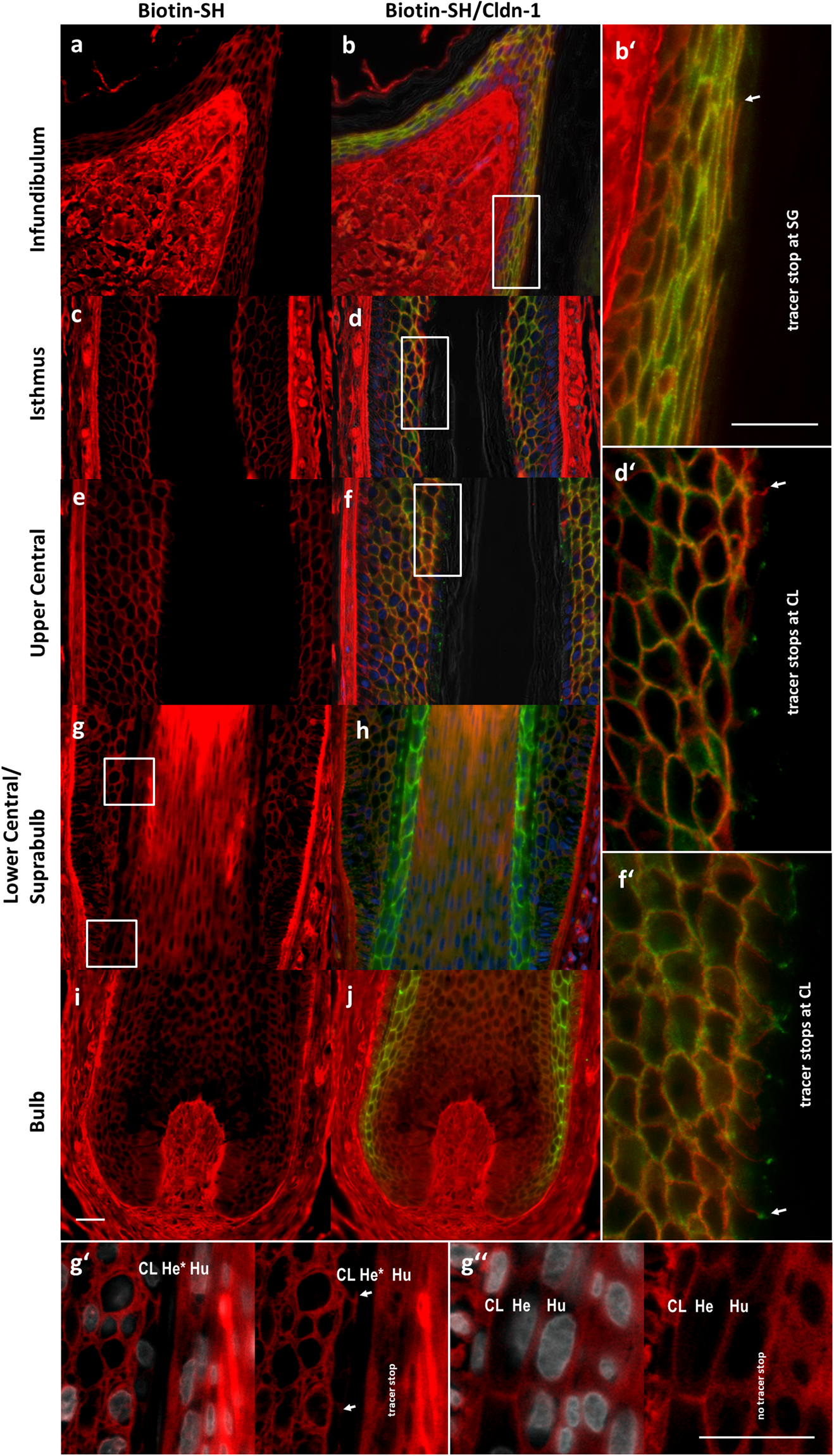 Tight Junction barriers in human hair follicles – role of claudin-1 | Scientific Reports Tight Junction barriers in human hair follicles – role of claudin-1 | Scientific Reports