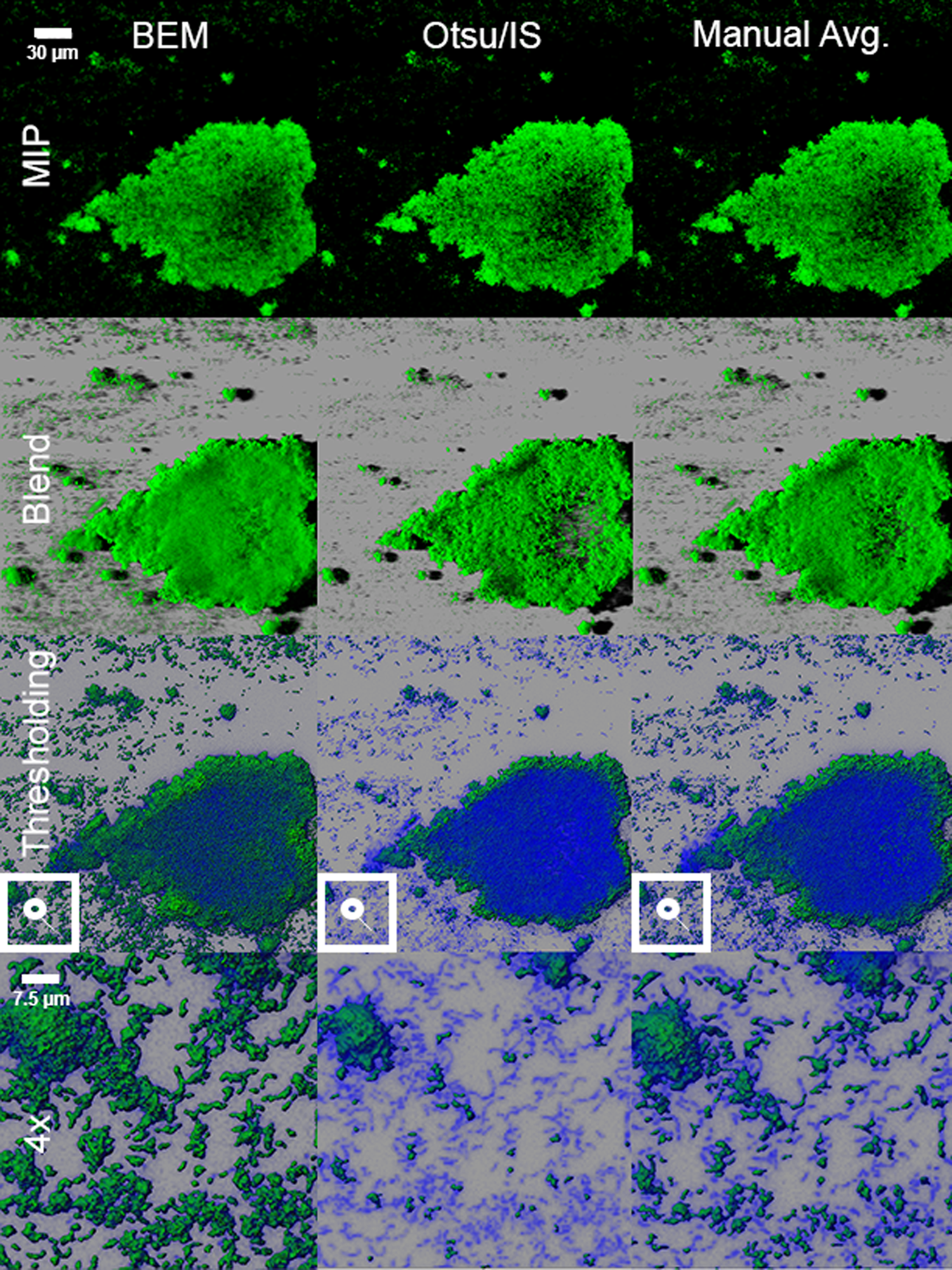 A Sensitive Thresholding Method for Confocal Laser Scanning Microscope  Image Stacks of Microbial Biofilms | Scientific Reports