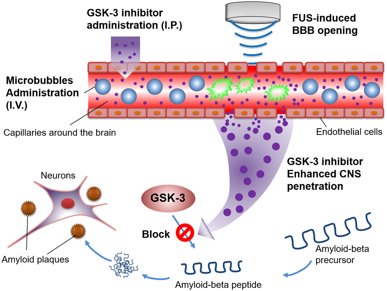 Focused Ultrasound Induced Blood Brain Barrier Opening Enhances Gsk 3 Inhibitor Delivery For Amyloid Beta Plaque Reduction Scientific Reports
