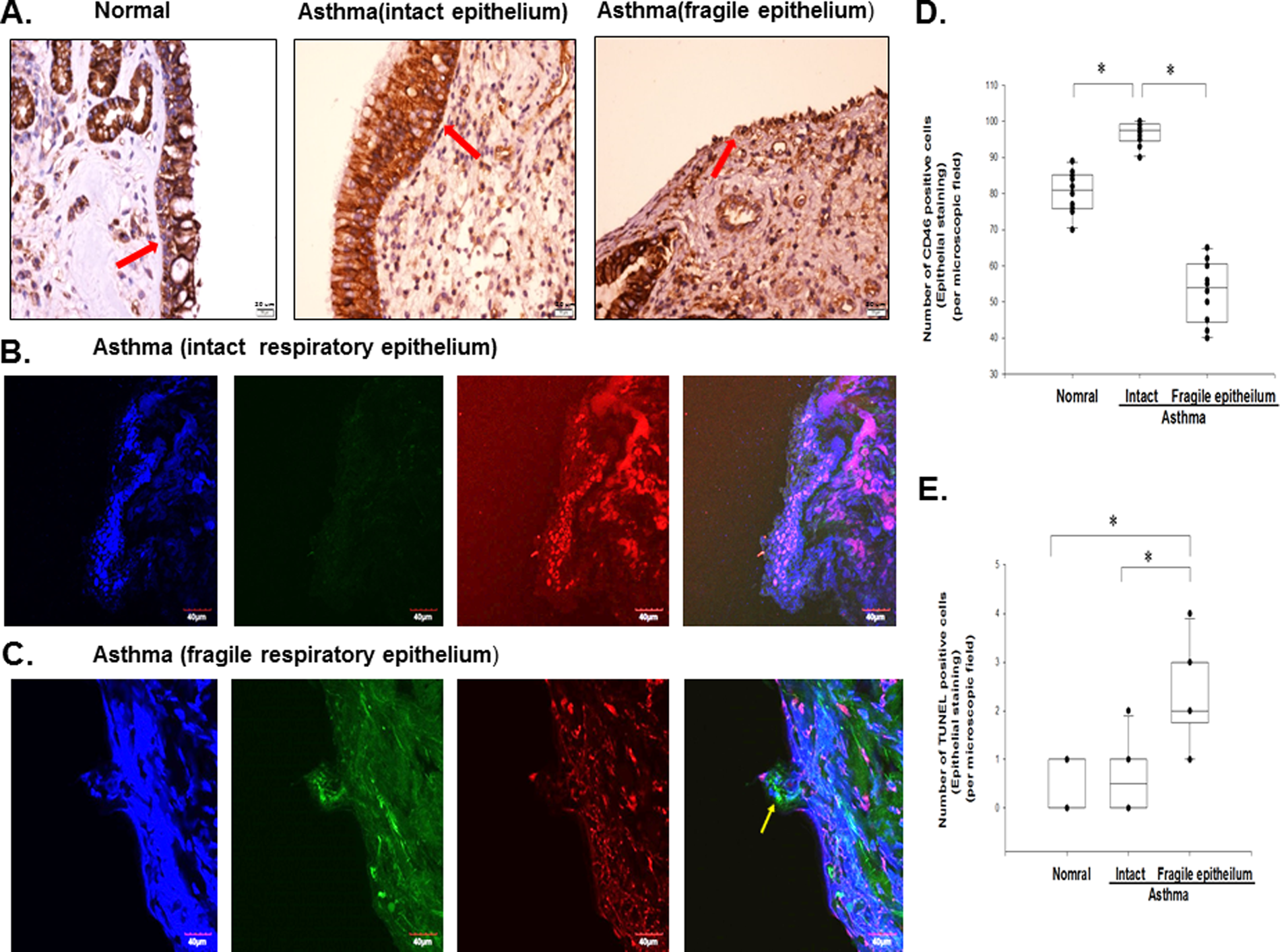 Complement Regulatory Protein Cd46 Induces Autophagy Against - 