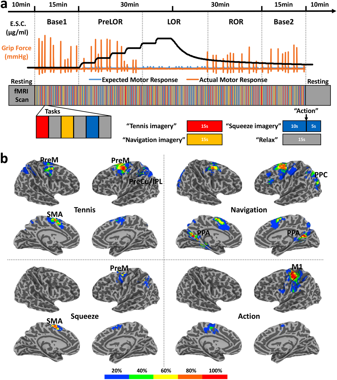 Brain scans are putting a major theory of consciousness to the test