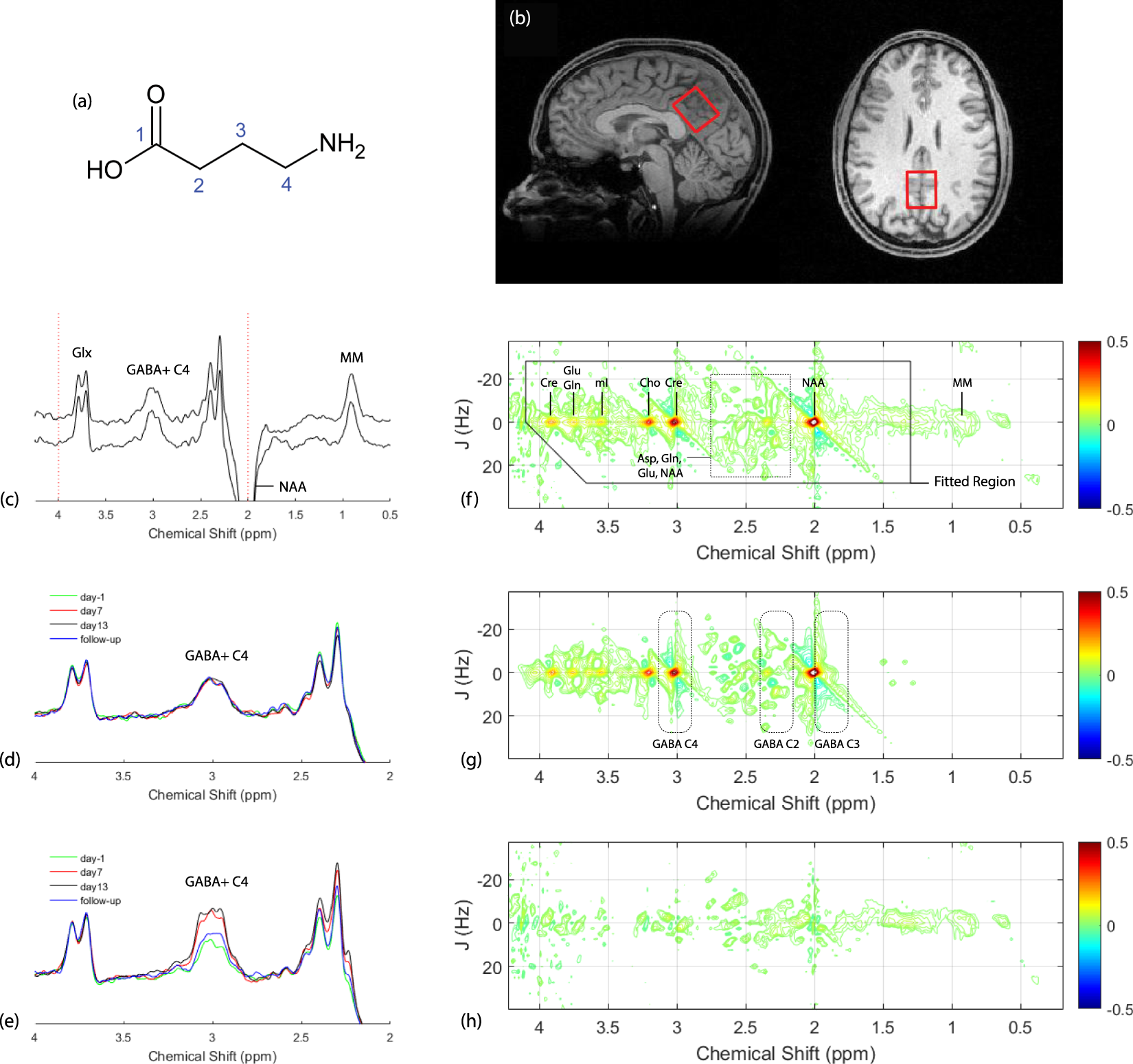 Two-Dimensional Proton Magnetic Resonance Spectroscopy versus J-Editing for  GABA Quantification in Human Brain: Insights from a GABA-Aminotransferase  Inhibitor Study | Scientific Reports