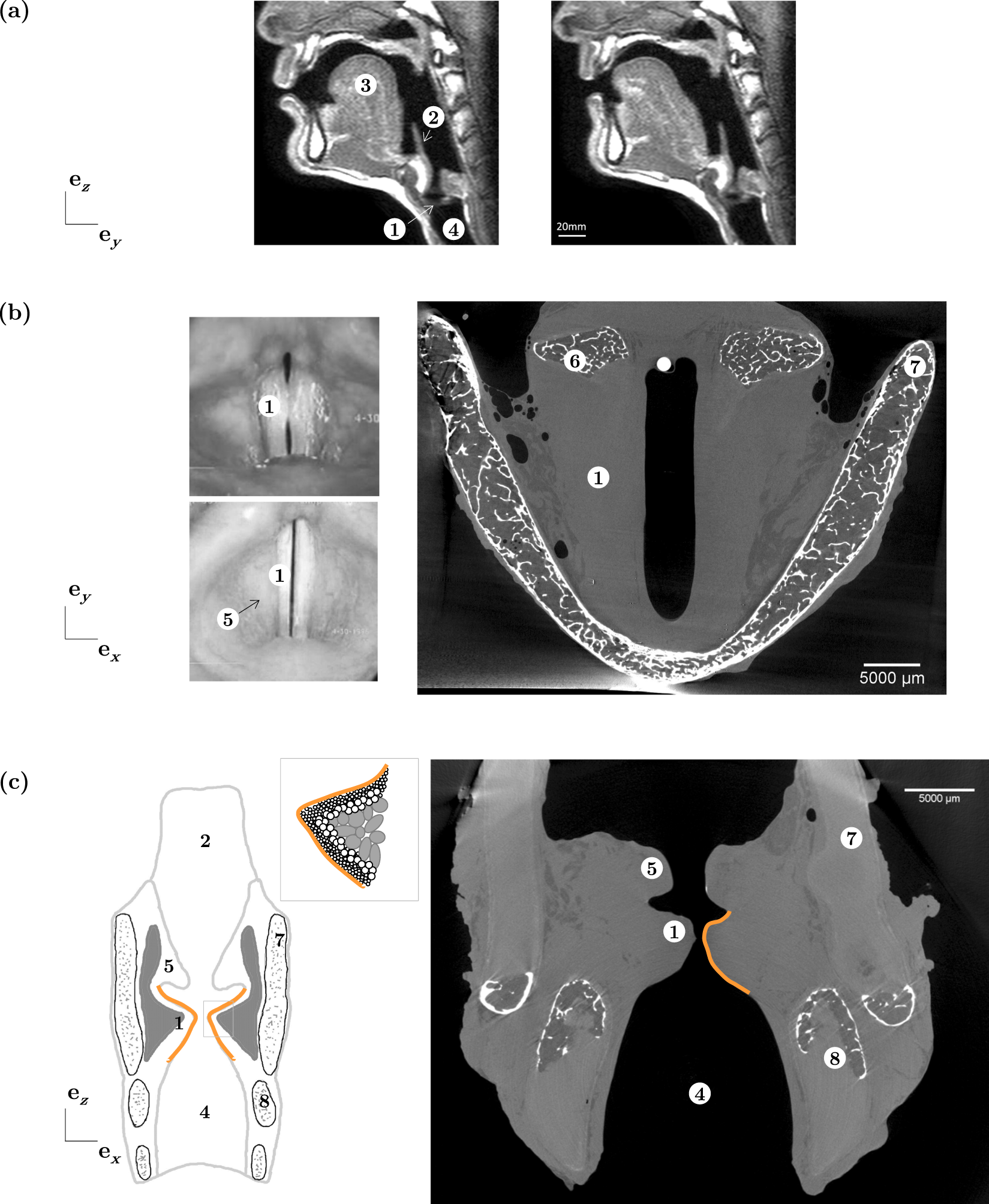 3d Multiscale Imaging Of Human Vocal Folds Using Synchrotron X Ray