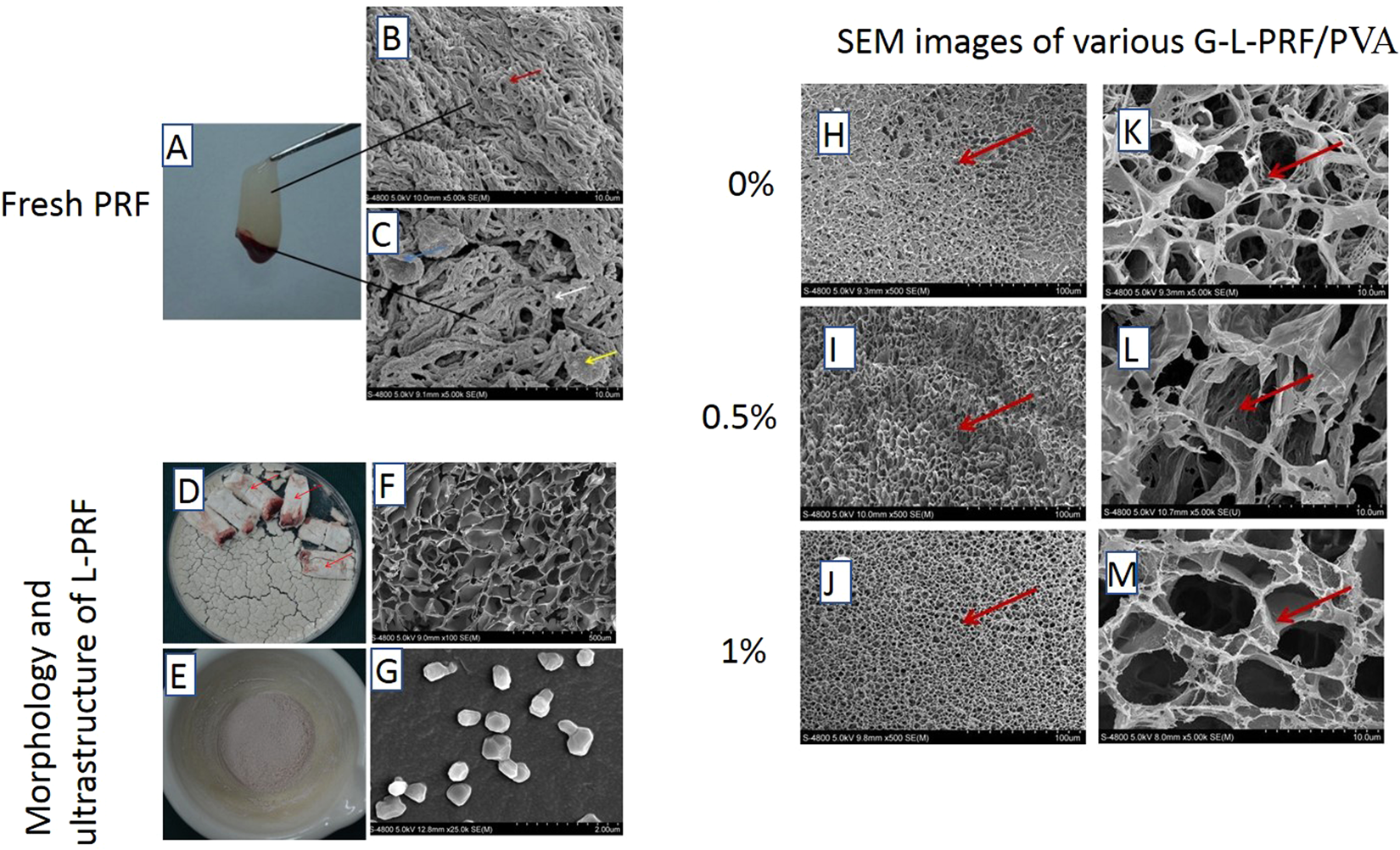 Frontiers  Polyvinyl alcohol coating prevents platelet adsorption and  improves mechanical property of polycaprolactone-based small-caliber  vascular graft