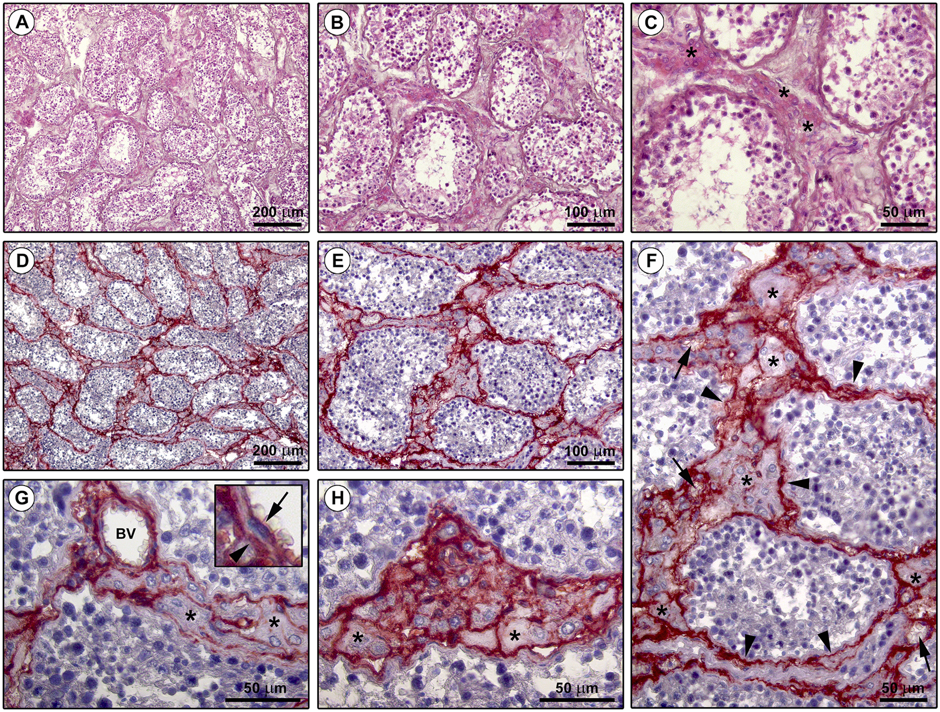 Reappraising the microscopic anatomy of human testis: identification of  telocyte networks in the peritubular and intertubular stromal space |  Scientific Reports