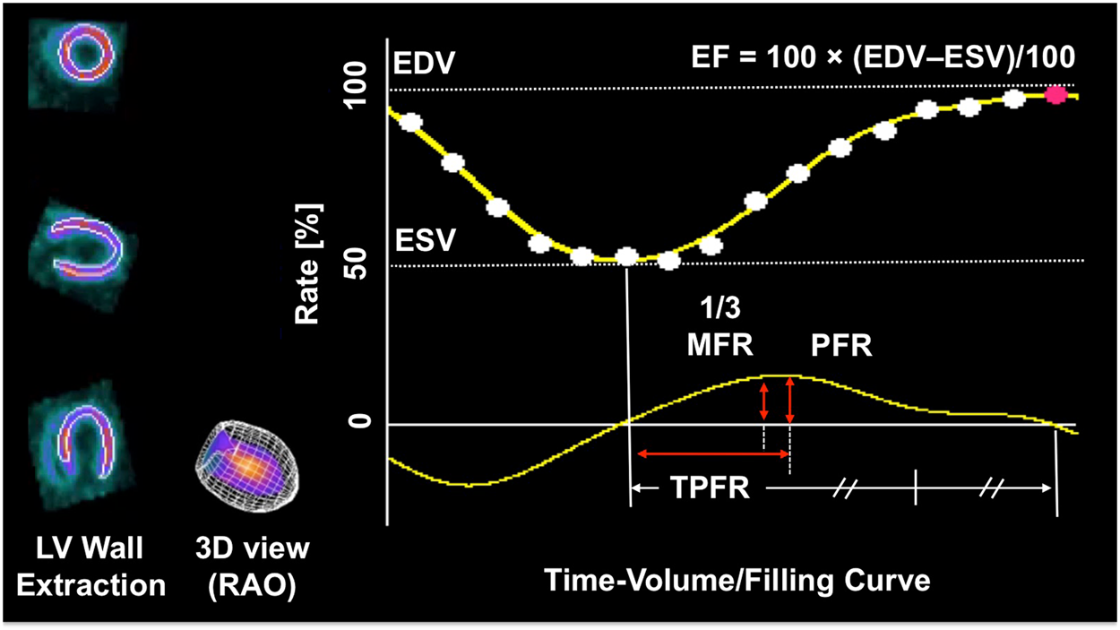 Left Ventricular Dysfunction in Rat Model of Diabetic Cardiomyopathy using ECG-gated 18F-FDG PET | Scientific Reports