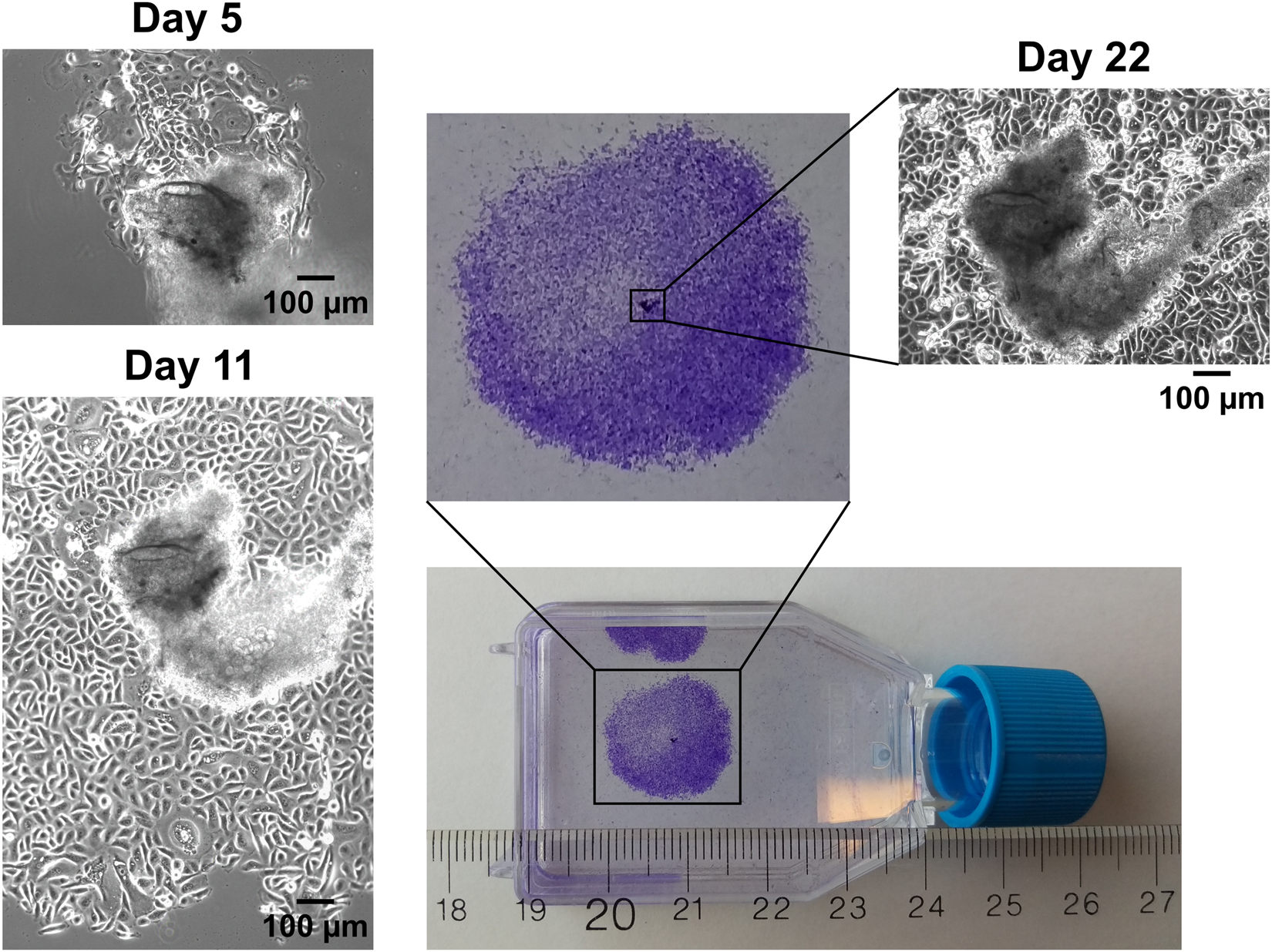 Isolation of Biopsy-Derived, Human Cervical Keratinocytes Propagated as  Monolayer and Organoid Cultures | Scientific Reports