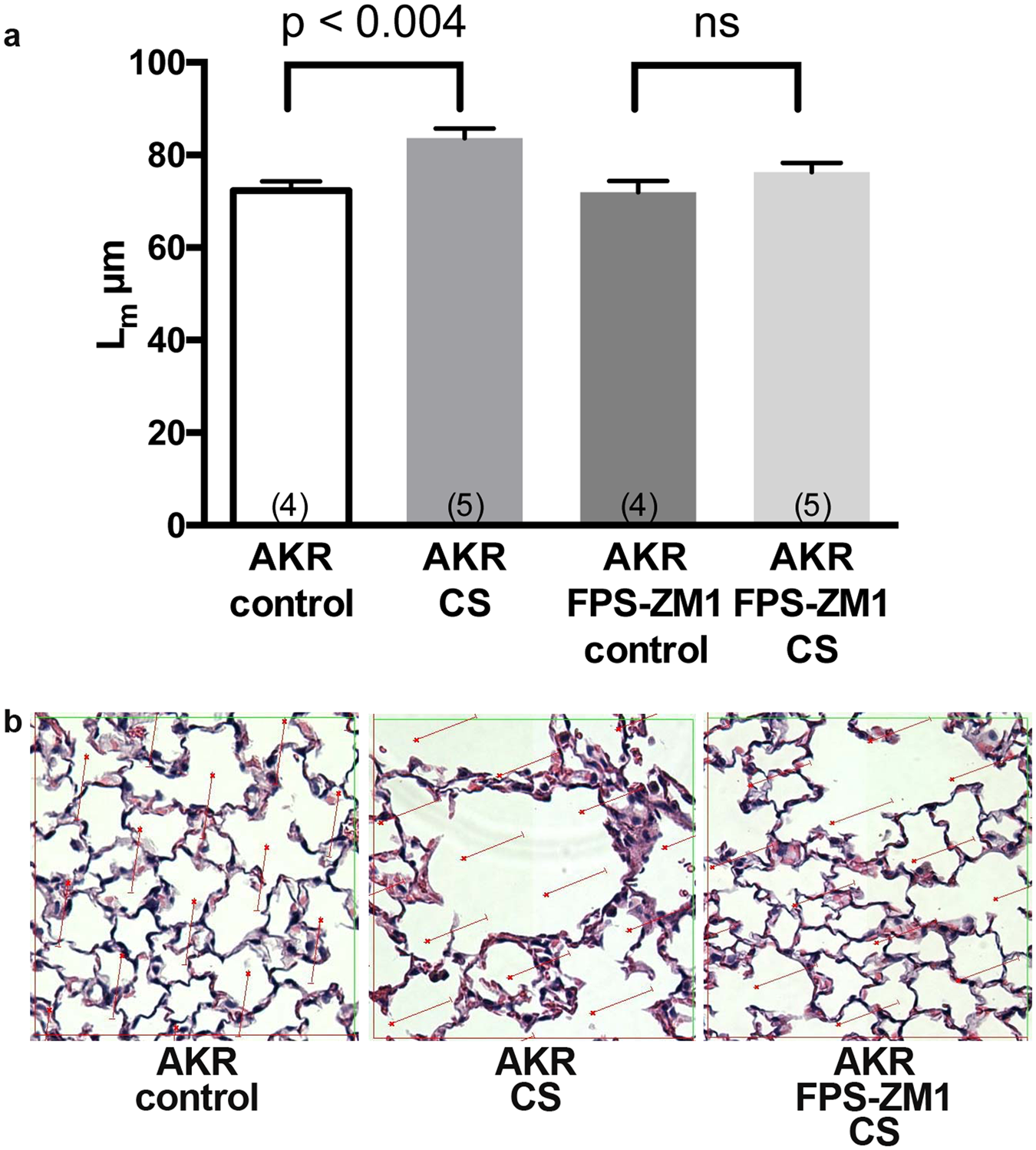 RAGE is a Critical Mediator of Pulmonary Oxidative Stress, Alveolar  Macrophage Activation and Emphysema in Response to Cigarette Smoke |  Scientific Reports