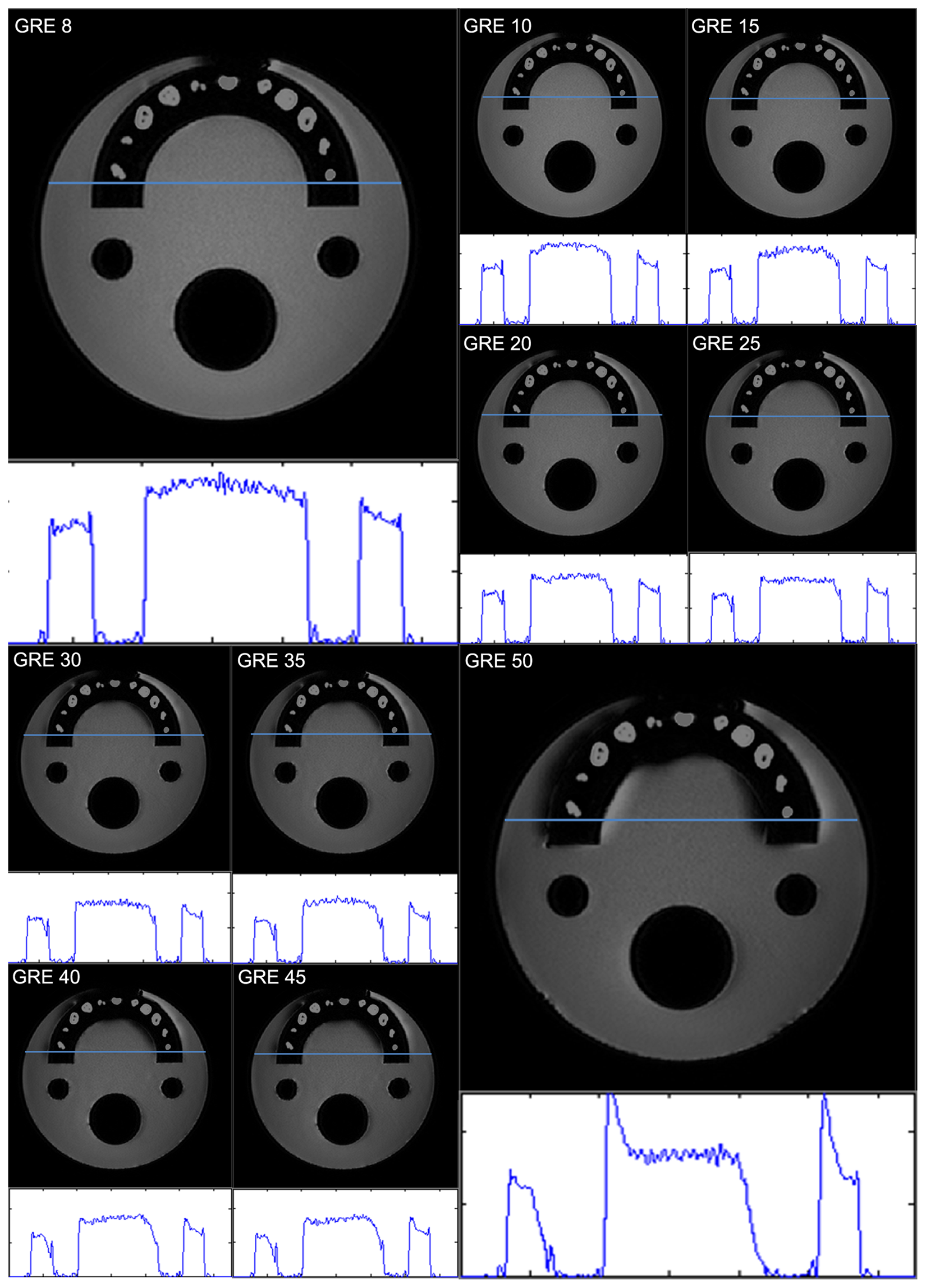Metal Artifacts With Dental Implants Evaluation Using A