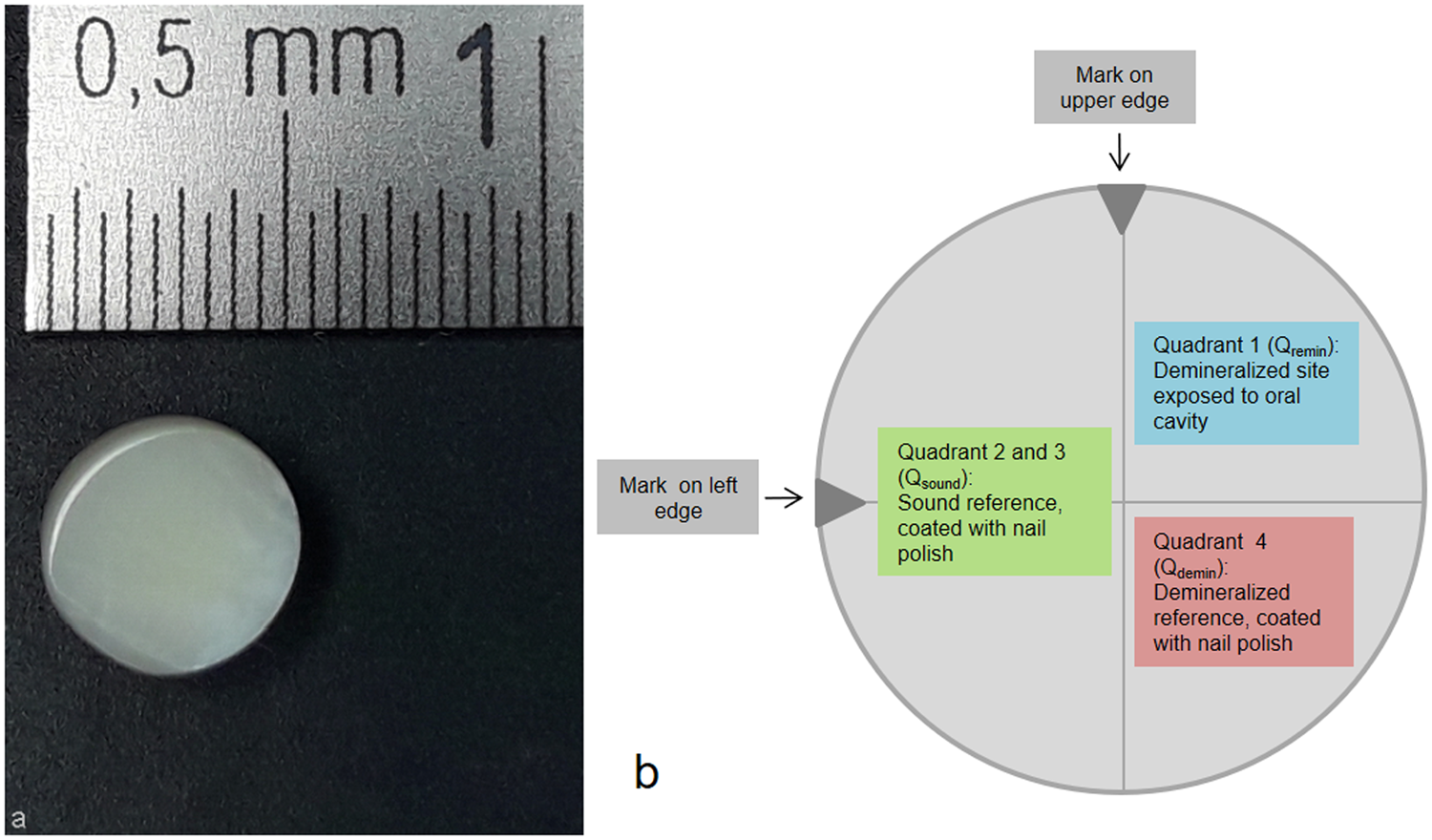 Randomised in situ clinical trial investigating self-assembling peptide  matrix P11-4 in the prevention of artificial caries lesions | Scientific  Reports