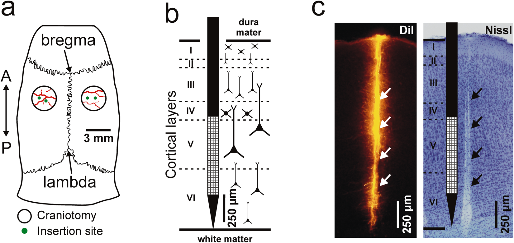 slow insertion of silicon probes improves the quality of acute