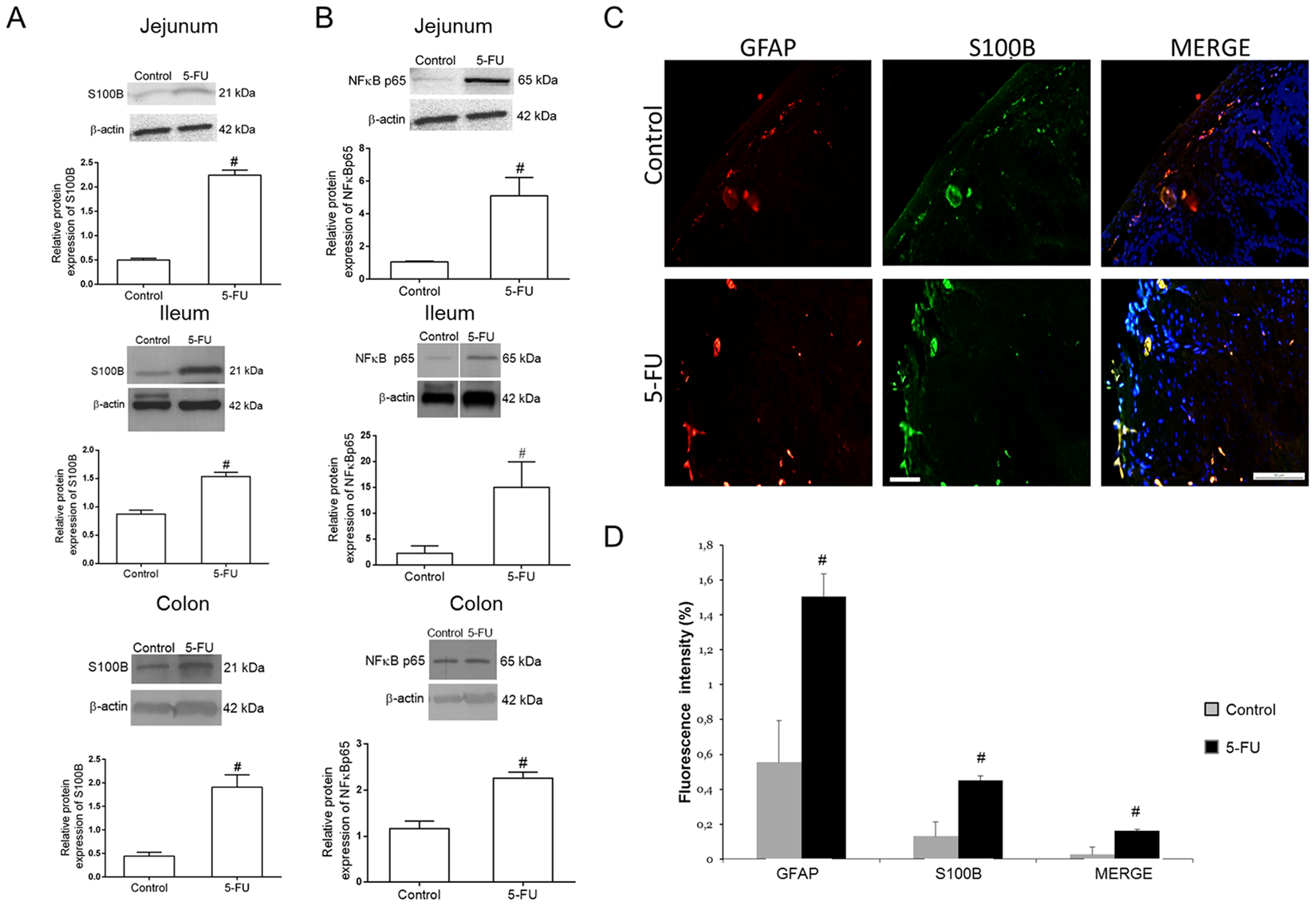 5 Fluorouracil Induces Enteric Neuron Death And Glial Activation During Intestinal Mucositis Via A S100b Rage Nfkb Dependent Pathway Scientific Reports