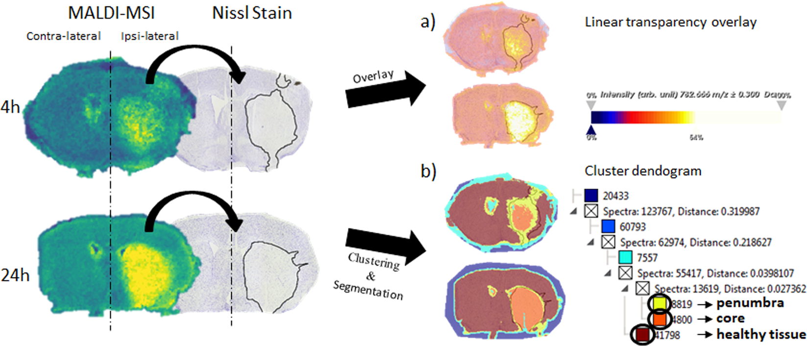 Distinguishing core from penumbra by lipid profiles using ...
