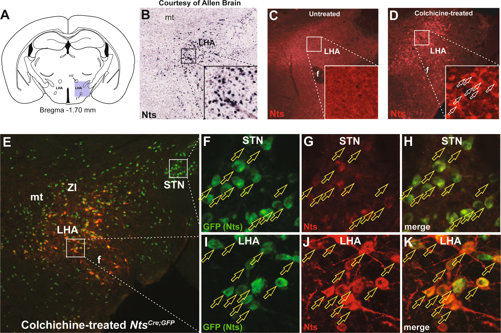 TrkB-expressing paraventricular hypothalamic neurons suppress