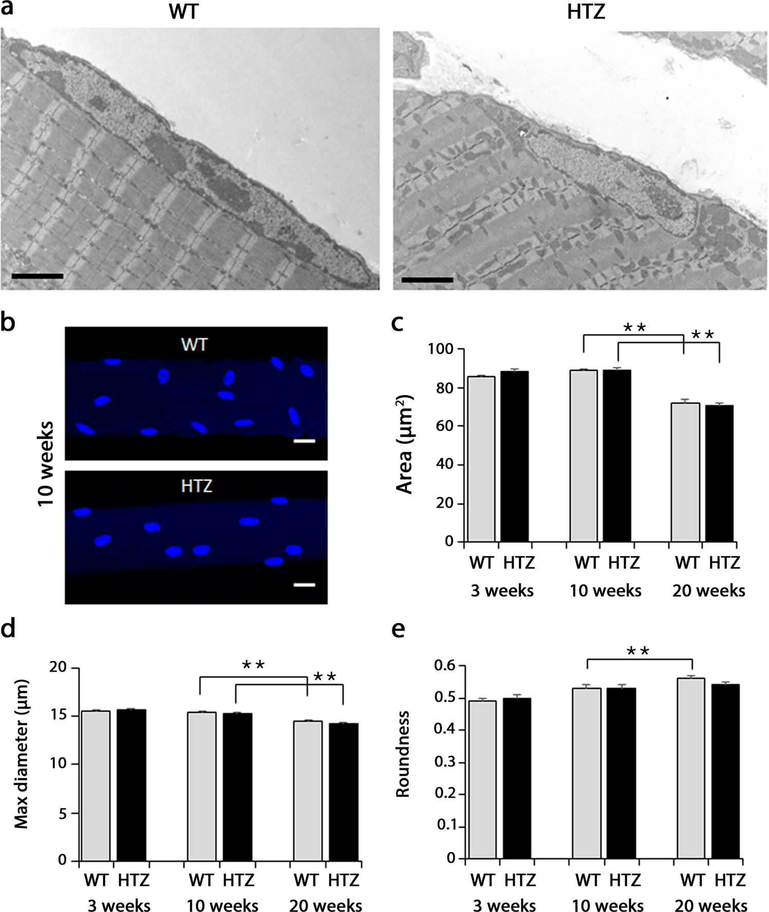 Differential impact of ubiquitous and muscle dynamin 2 isoforms in muscle  physiology and centronuclear myopathy