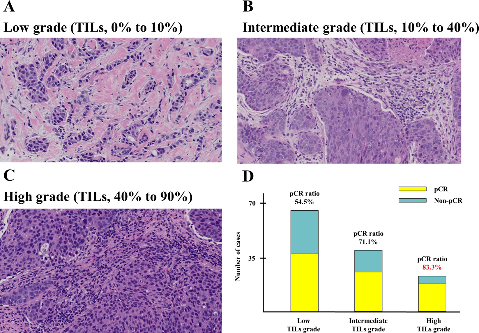 Prognostic utility of tumor-infiltrating lymphocytes in residual tumor  after neoadjuvant chemotherapy with trastuzumab for HER2-positive breast  cancer | Scientific Reports