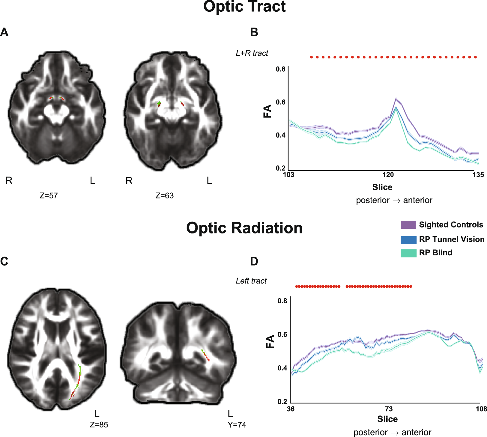 Reorganizations of latency structures within the white matter from