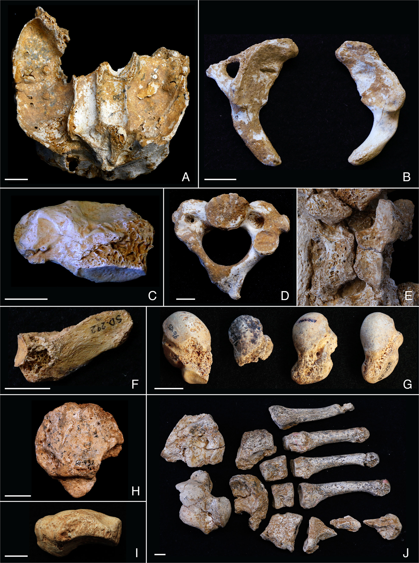 Skeletal Anomalies in The Neandertal Family of El Sidrón (Spain) Support A  Role of Inbreeding in Neandertal Extinction | Scientific Reports