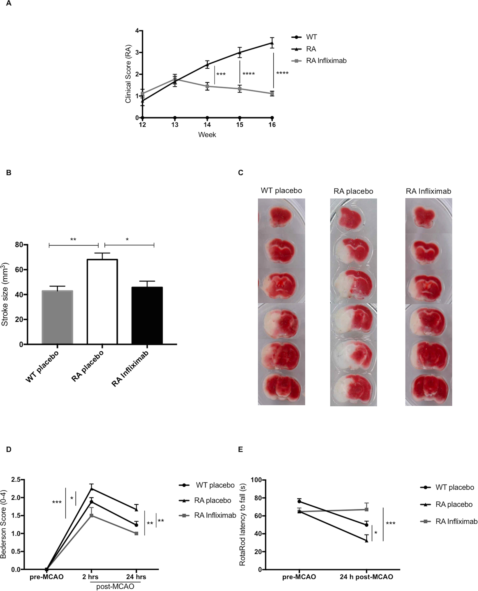 Tumour Necrosis Factor A Inhibition Improves Stroke Outcome In A