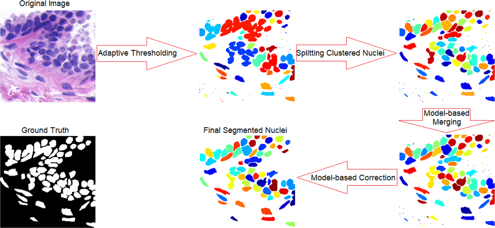 Segmentation Of Heavily Clustered Nuclei From