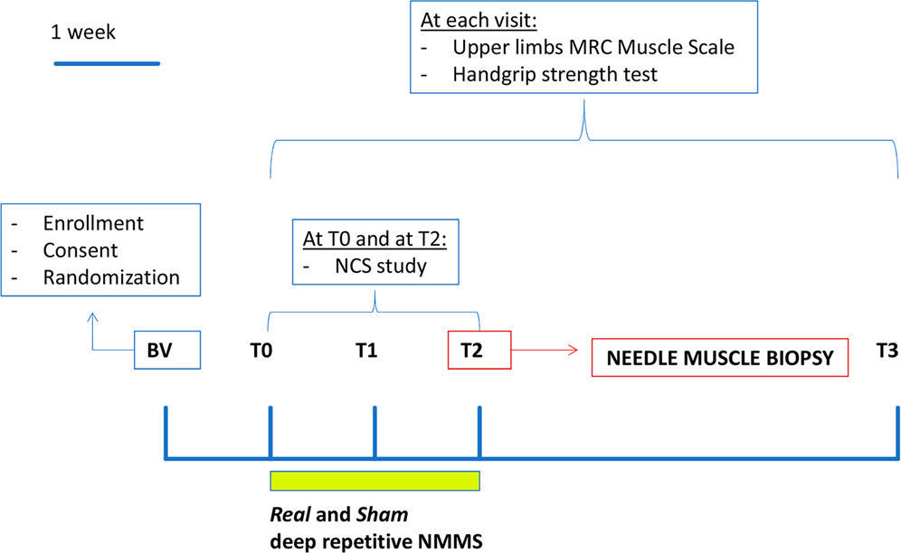 Als Progression Chart