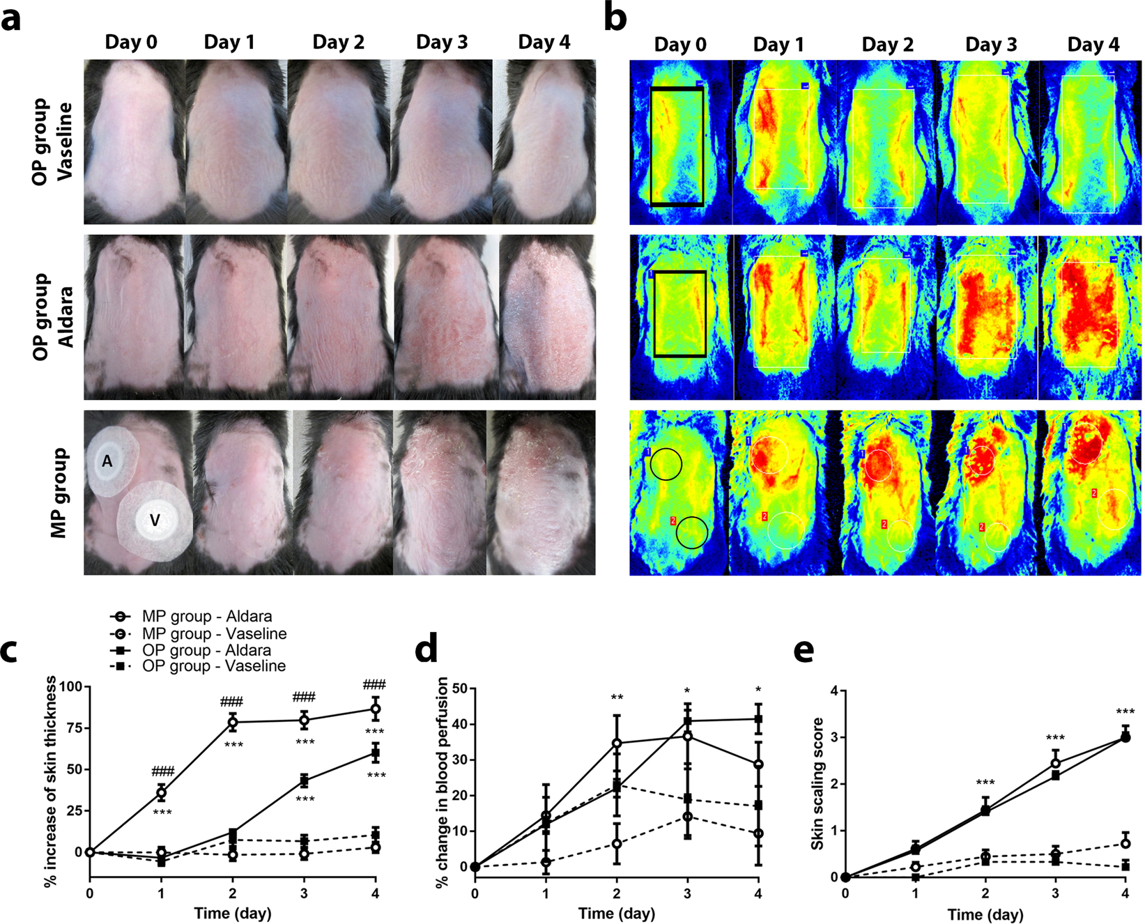 Mouse Model Yields Possible Treatment >> Methodological Refinement Of Aldara Induced Psoriasiform Dermatitis Mouse Model Yields Possible Treatment >> Methodological Refinement Of Aldara Induced Psoriasiform Dermatitis