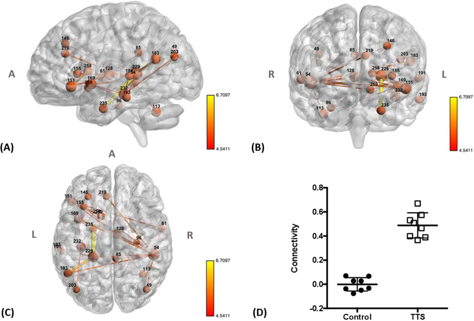 Brain test 140. Wpw синдром. Мозг сеть проводников. Functional Connectivity в неврологии медицинский английский. Микродозинг мусцимола.