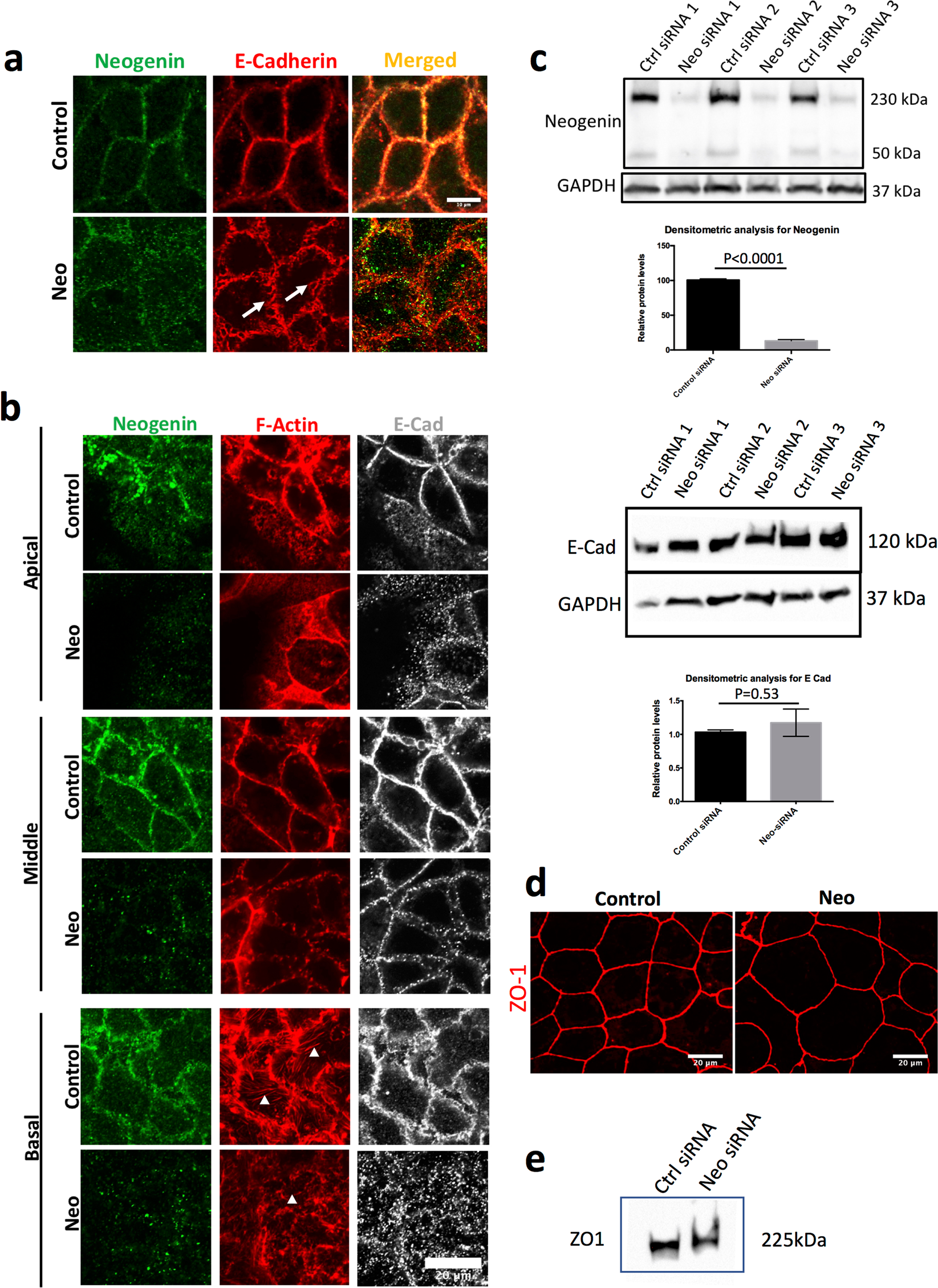 Loss Of Neogenin1 In Human Colorectal Carcinoma Cells Causes