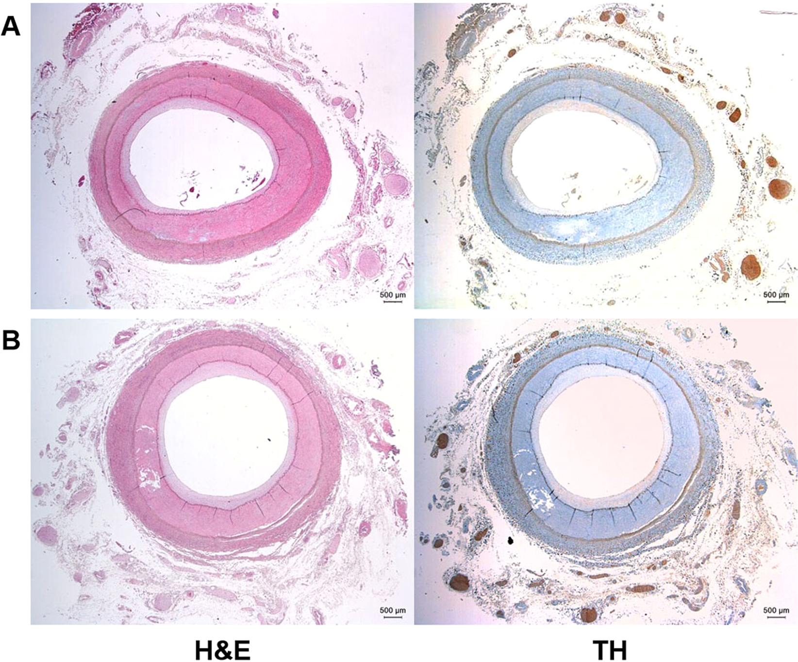 Anatomic Conformation Of Renal Sympathetic Nerve Fibers In Living Human Tissues Scientific Reports