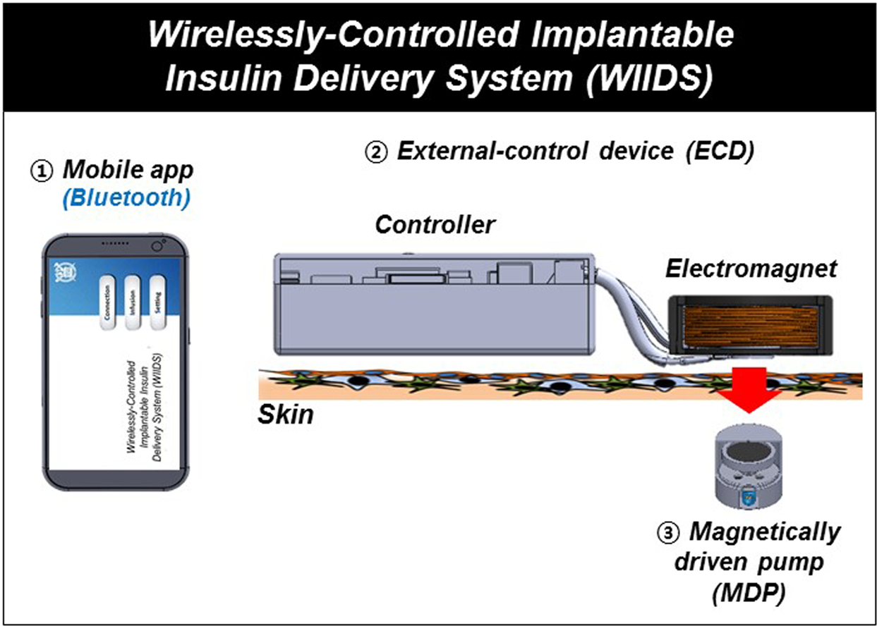 Wirelessly Controlled Implantable System for On-demand and Pulsatile Insulin  Administration | Scientific Reports