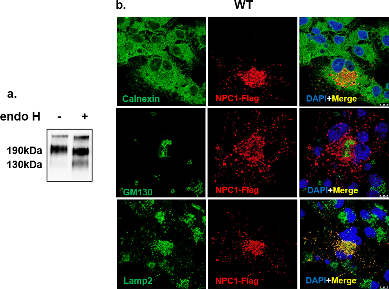 Niemann-Pick disease type C  Orphanet Journal of Rare Diseases