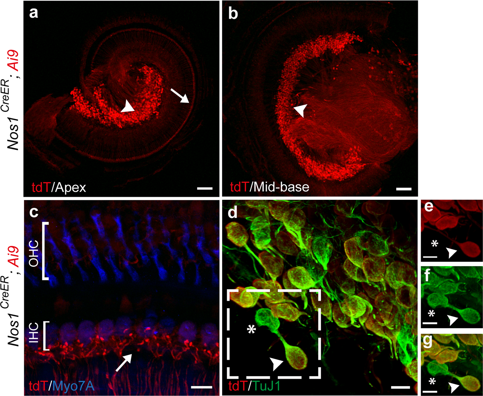 Characterization of transgenic mouse lines for labeling type I and type II  afferent neurons in the cochlea | Scientific Reports