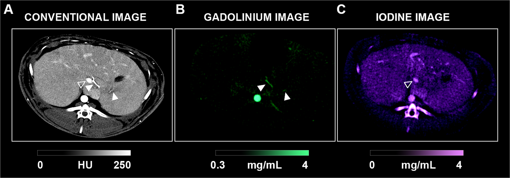 Spectral Photon Counting Computed Tomography Spcct In Vivo Single Acquisition Multi Phase Liver Imaging With A Dual Contrast Agent Protocol Scientific Reports