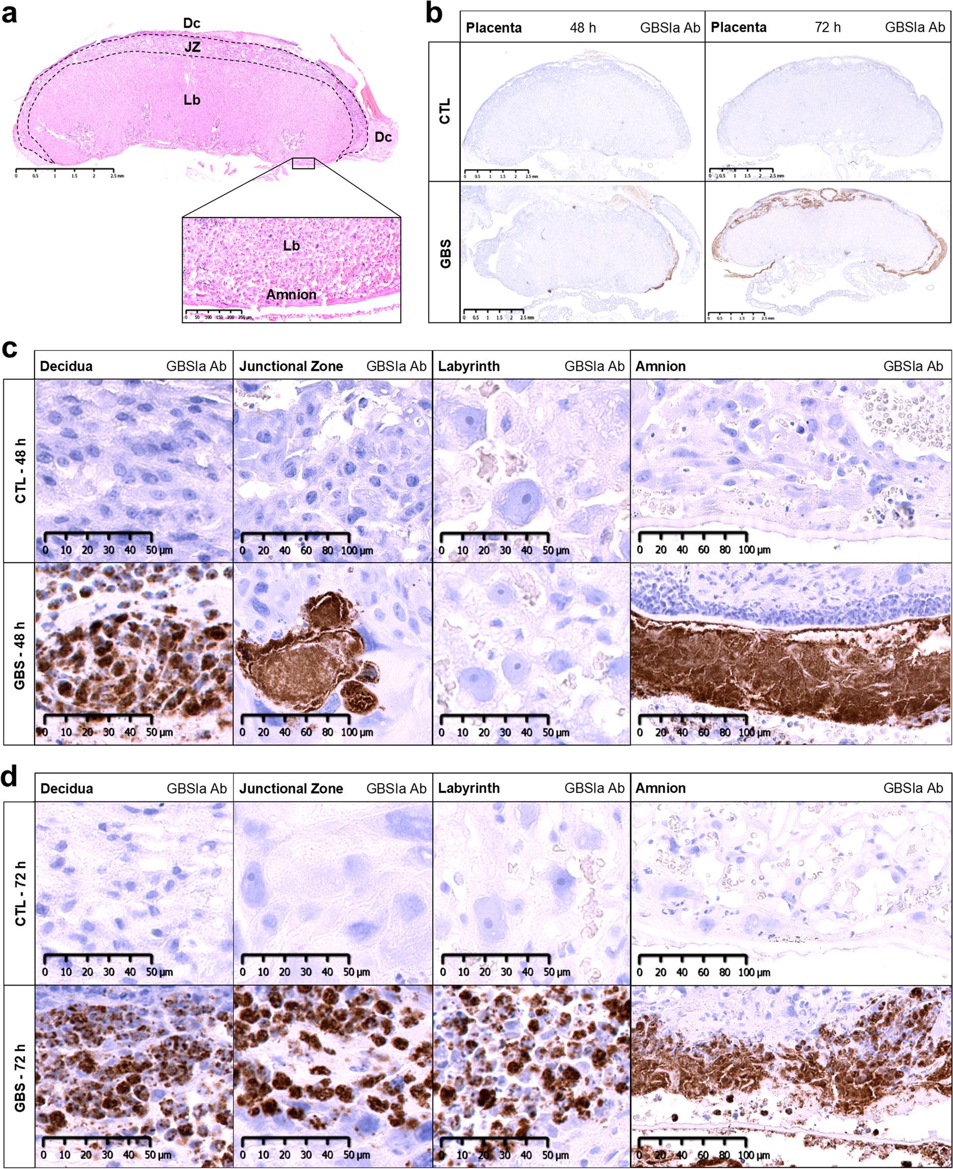 Sex-specific maternofetal innate immune responses triggered by group B  Streptococci | Scientific Reports