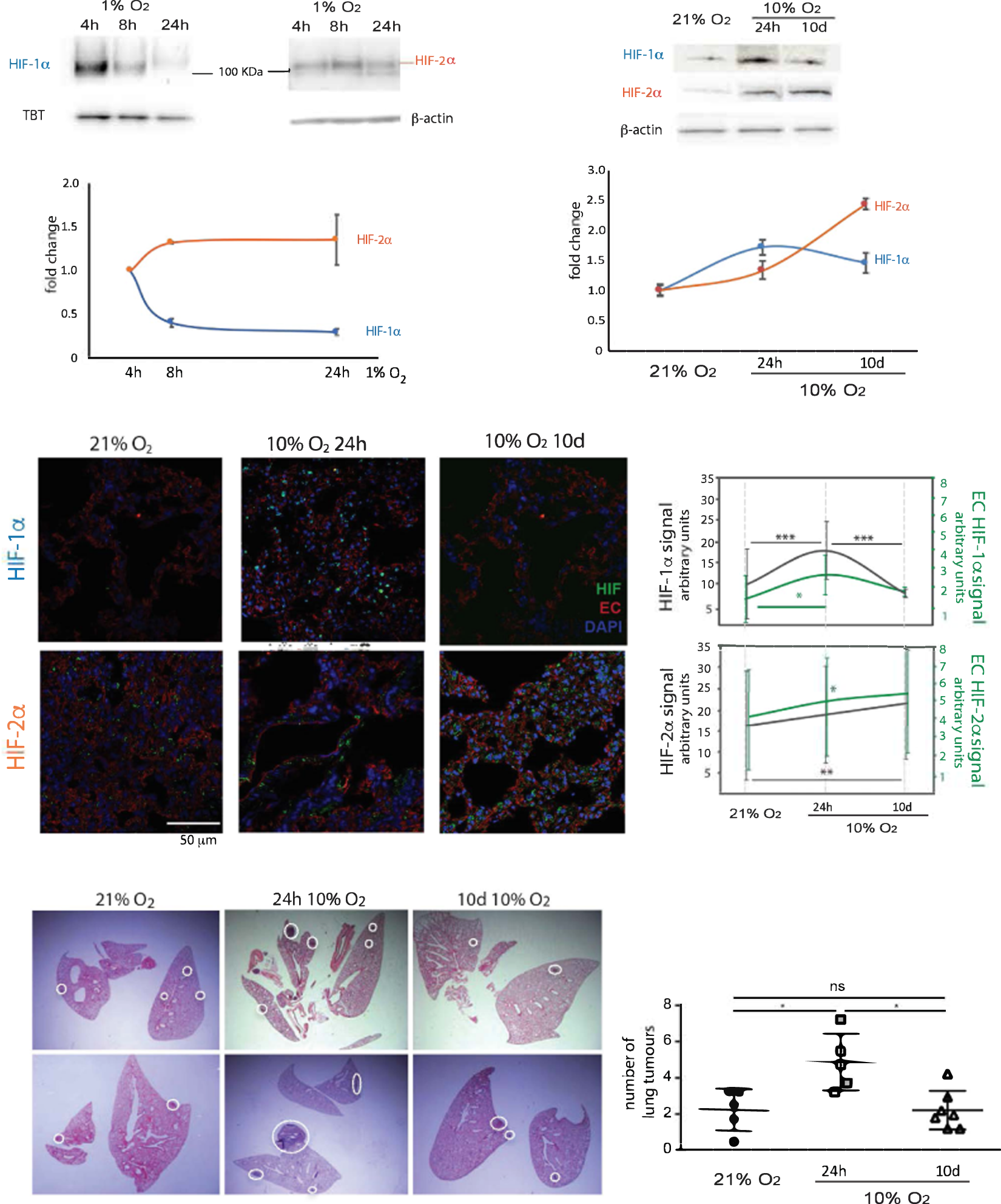 Acute And Chronic Hypoxia Differentially Predispose Lungs