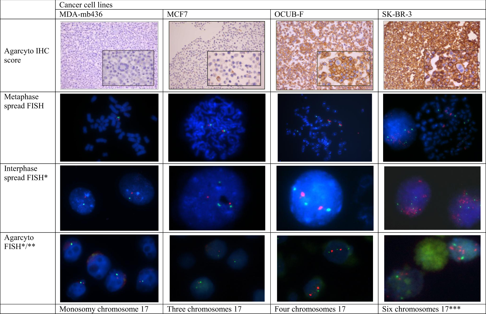 Her2 Chromosome 17 Polysomy And Dna Ploidy Status In Breast Cancer A Translational Study Scientific Reports