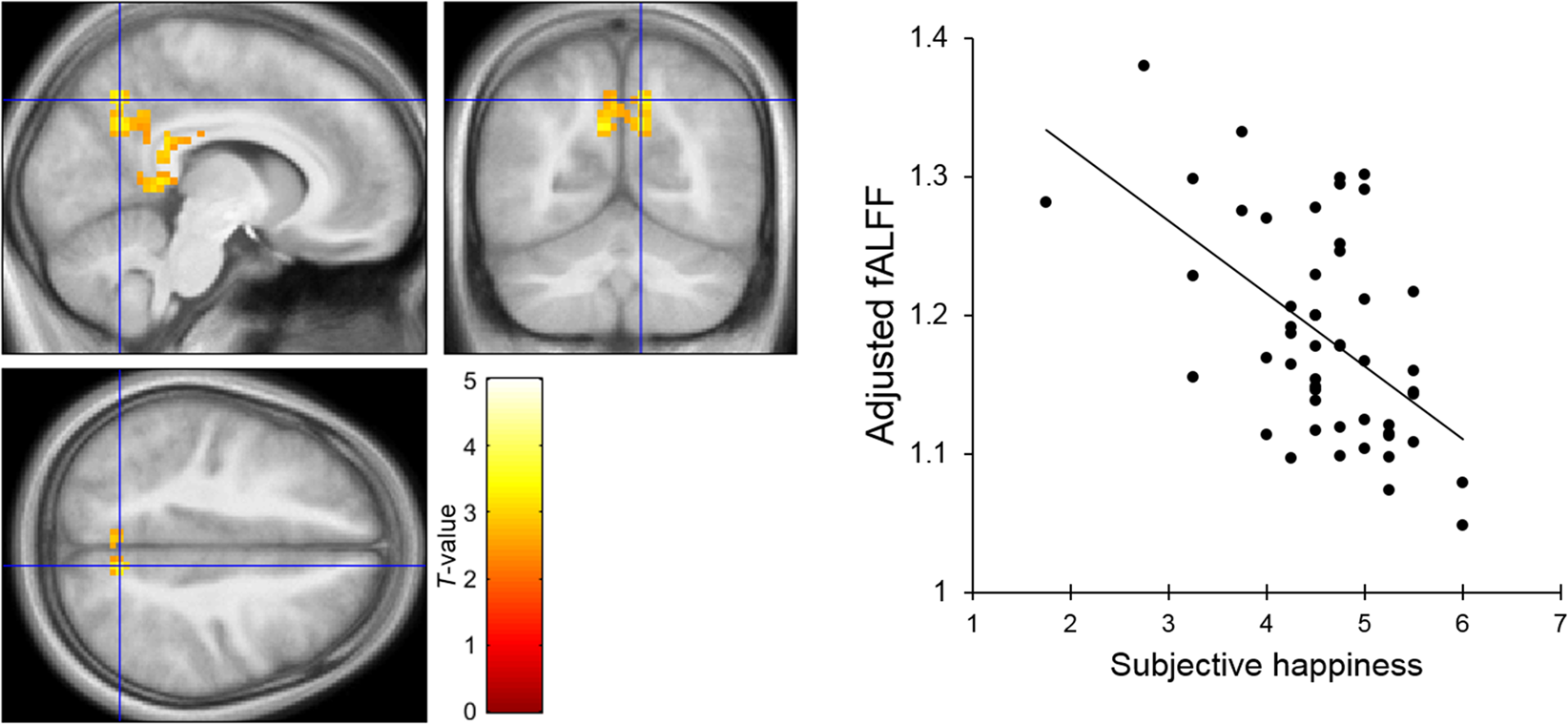 Resting State Neural Activity And Connectivity Associated With Subjective Happiness Scientific Reports Resting State Neural Activity And Connectivity Associated With Subjective Happiness Scientific Reports
