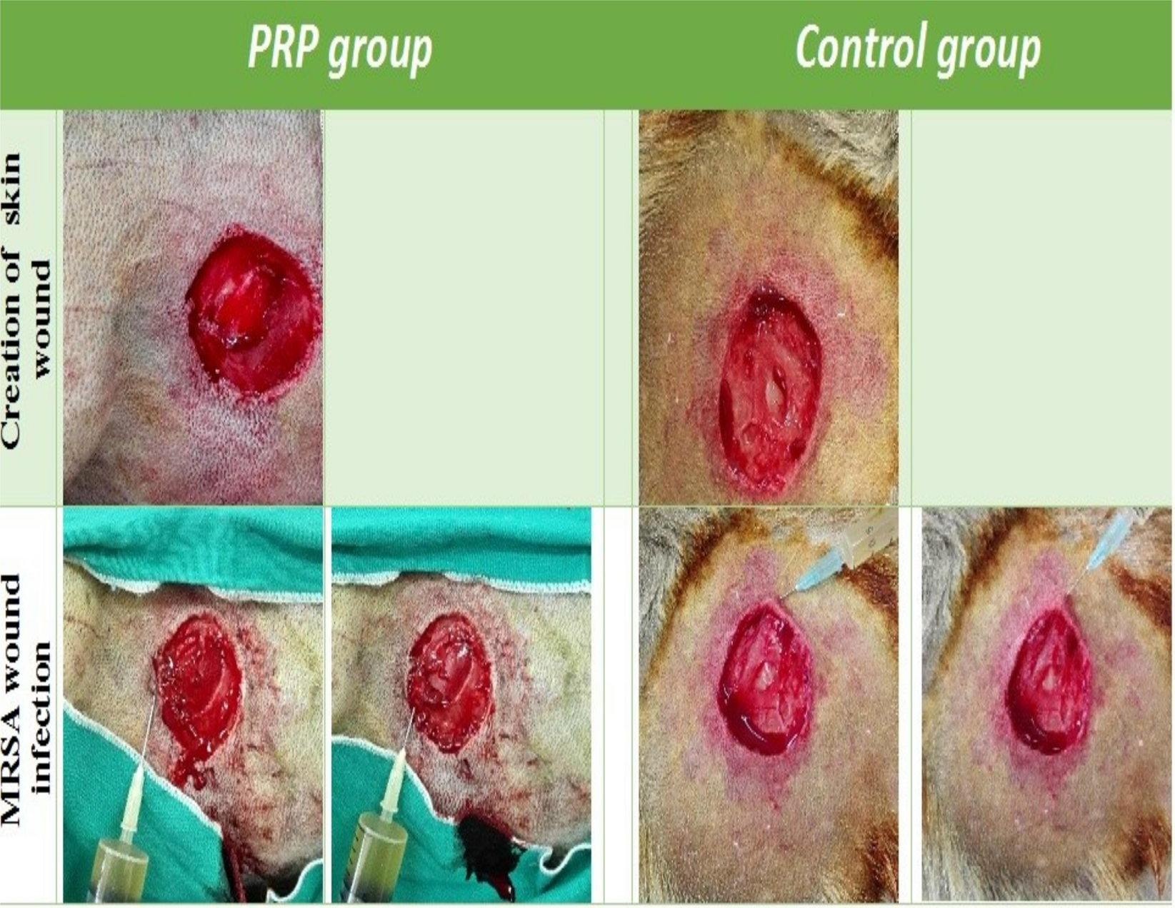 Antimicrobial action of autologous platelet-rich plasma on MRSA-infected  skin wounds in dogs | Scientific Reports