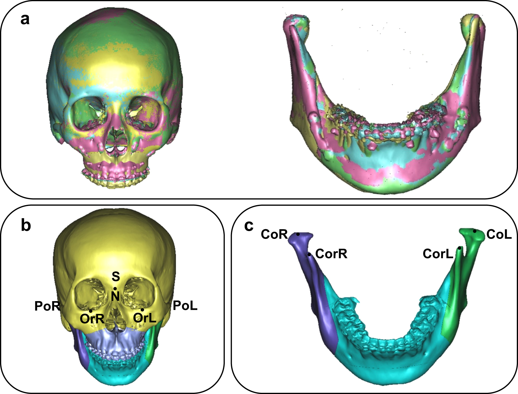 Evaluation of the postoperative stability of a counter-clockwise rotation technique for skeletal class II patients by using a novel three- dimensional position-posture method | Scientific Reports Evaluation of the postoperative stability of a counter-clockwise rotation technique for skeletal class II patients by using a novel three- dimensional position-posture method | Scientific Reports