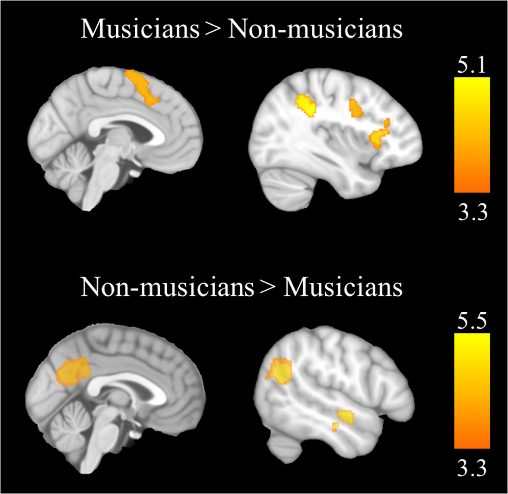 Different role of the supplementary motor area and the insula between  musicians and non-musicians in a controlled musical creativity task |  Scientific Reports