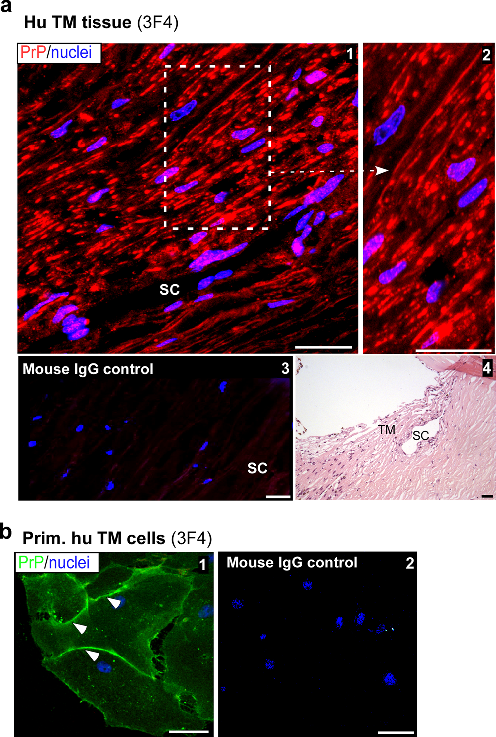 Prion Protein Modulates Endothelial To Mesenchyme Like Transition