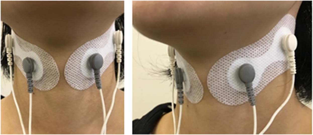 Transcutaneous Electrical Nerve Stimulation (TENS) & Interferential Current  Therapy (IFC) - Dubai Healthcare City