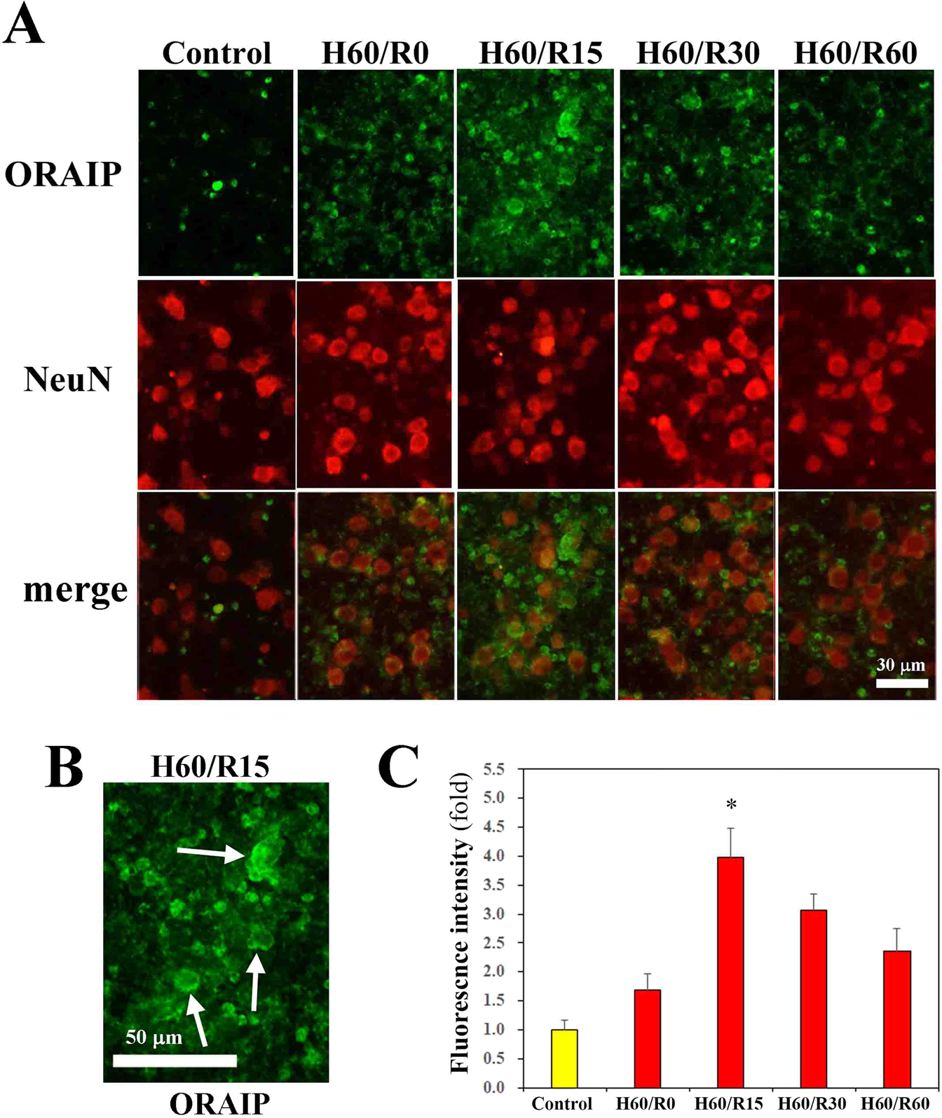 Oxidative Stress Responsive Apoptosis Inducing Protein Oraip Plays A Critical Role In Cerebral Ischemia Reperfusion Injury Scientific Reports