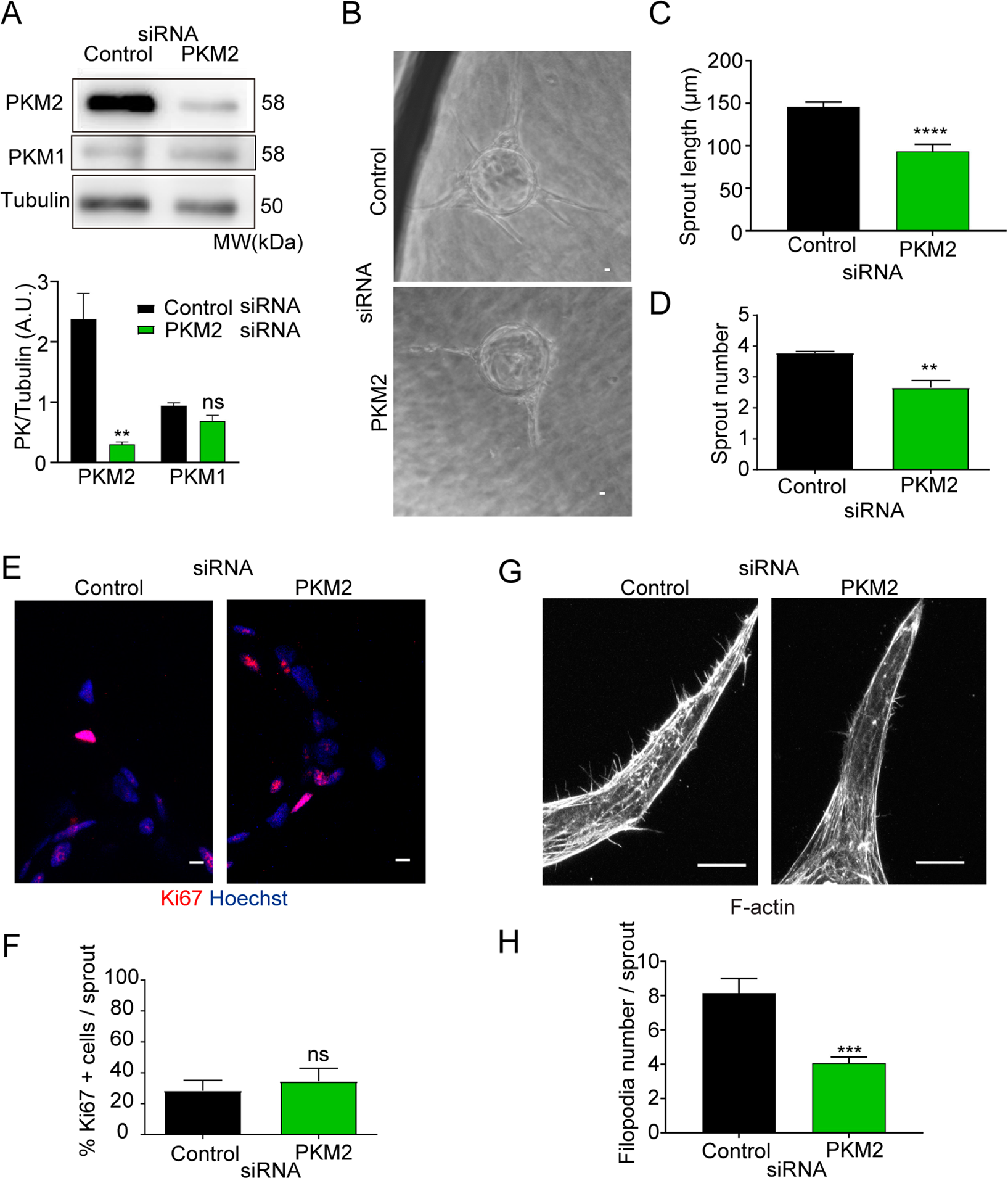 Pkm2 Regulates Endothelial Cell Junction Dynamics And Angiogenesis Via Atp Production Scientific Reports