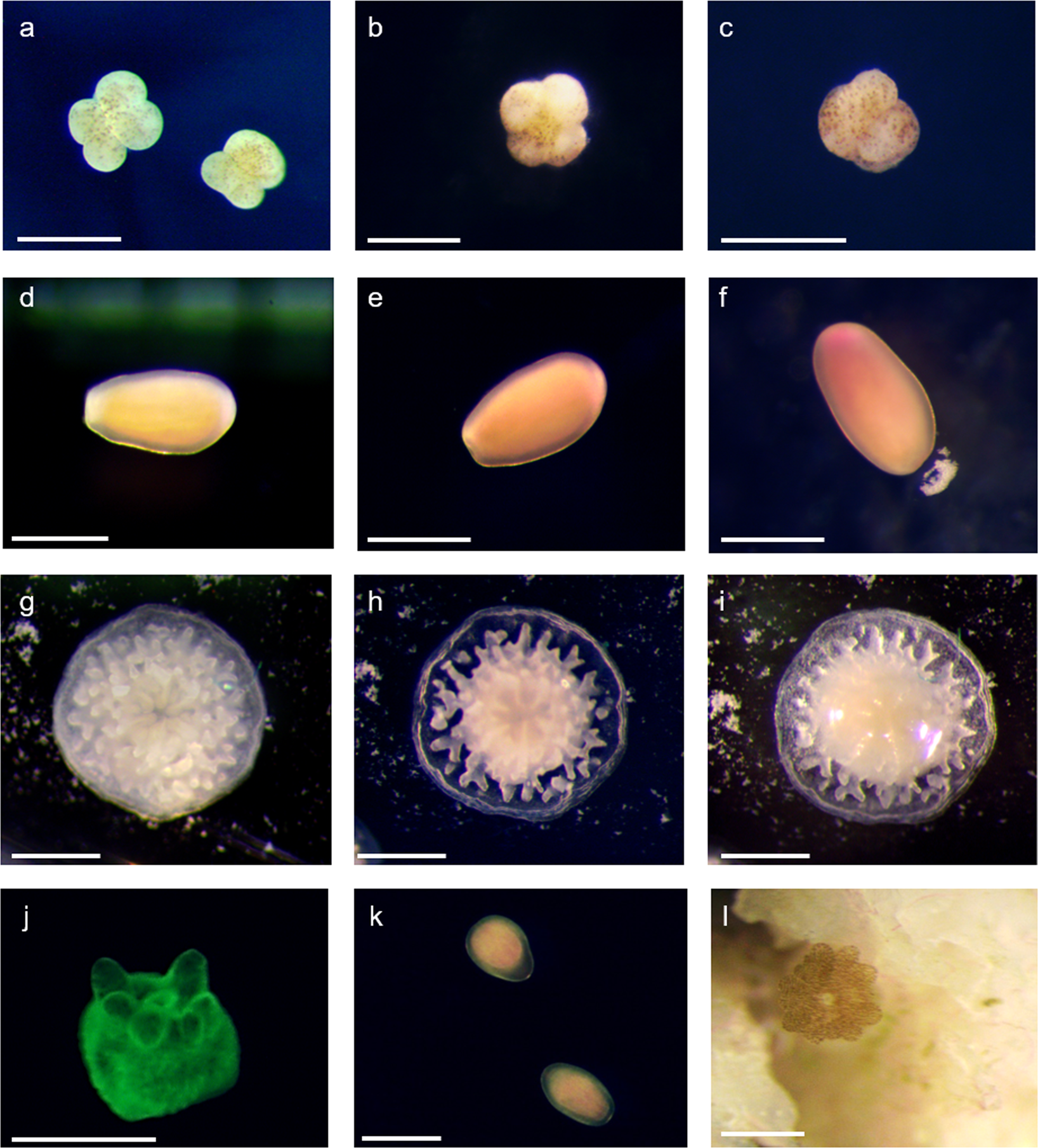 Normal and abnormal embryos and larvae of sand dollar S. mirabilis