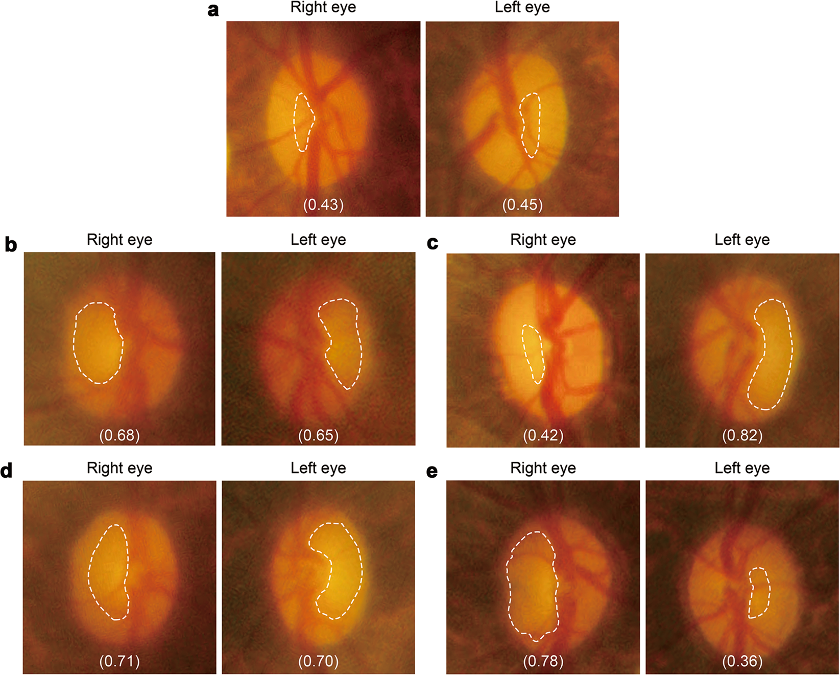 visual lighting tension