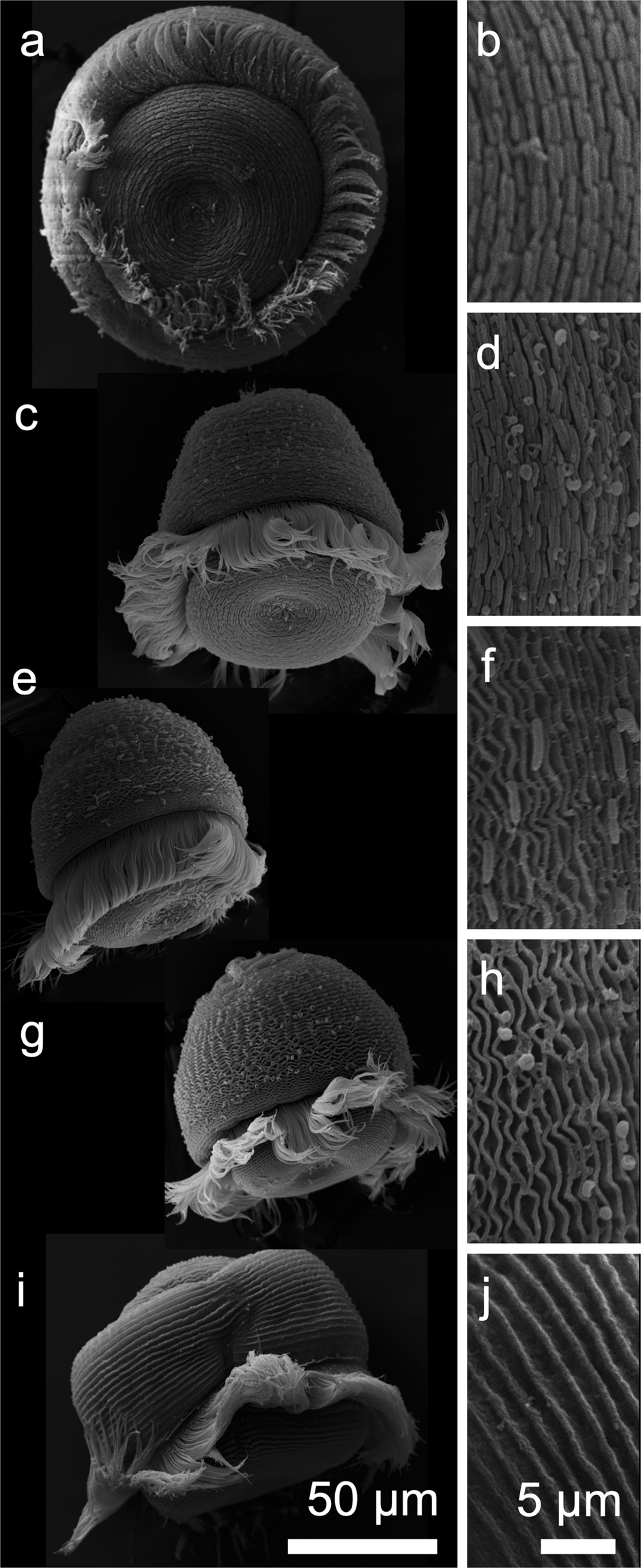 Thiotrophic bacterial symbiont induces polyphenism in giant ciliate host  Zoothamnium niveum | Scientific Reports