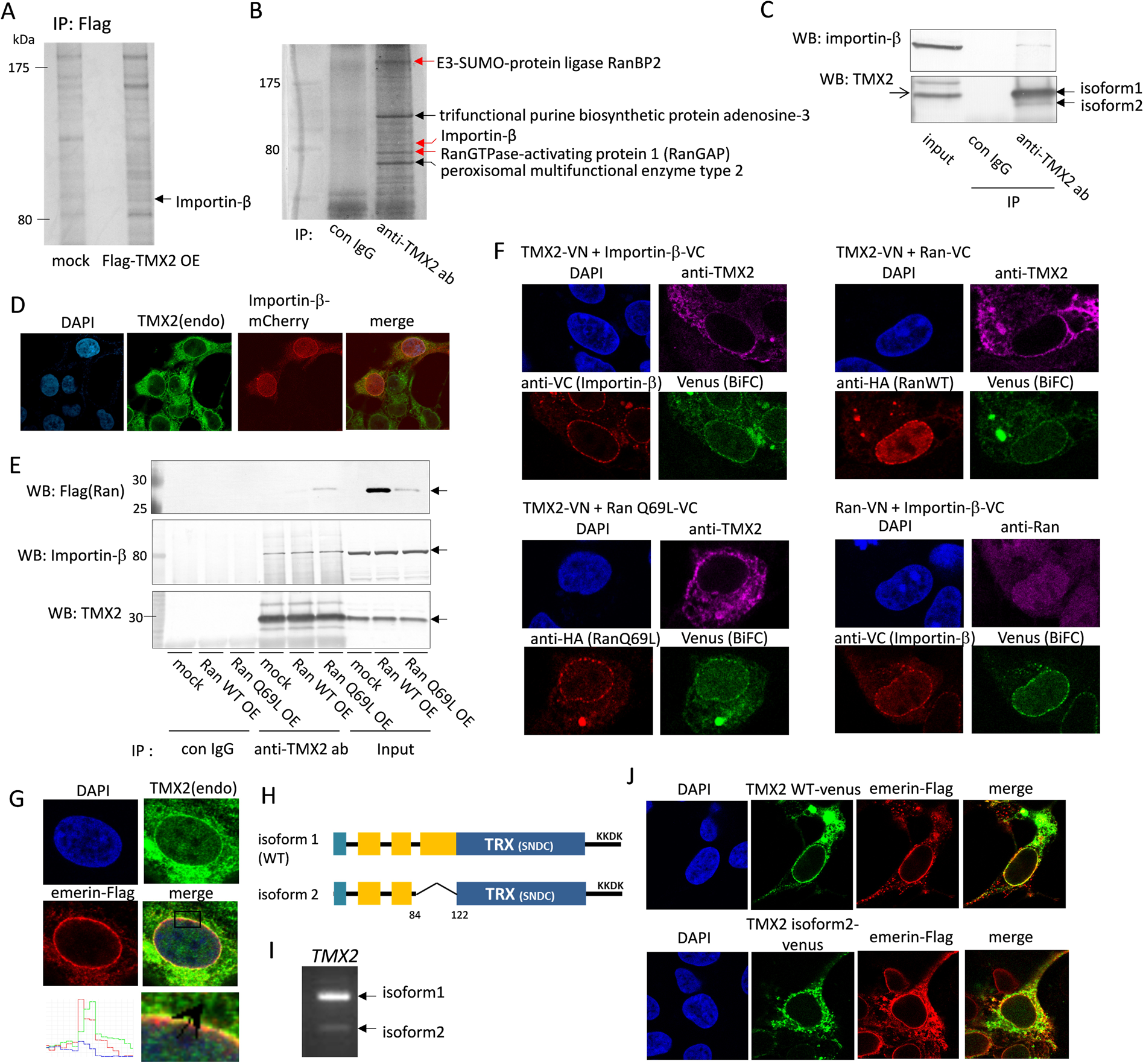 Thioredoxin-related transmembrane protein 2 (TMX2) regulates the Ran protein  gradient and importin-β-dependent nuclear cargo transport | Scientific  Reports